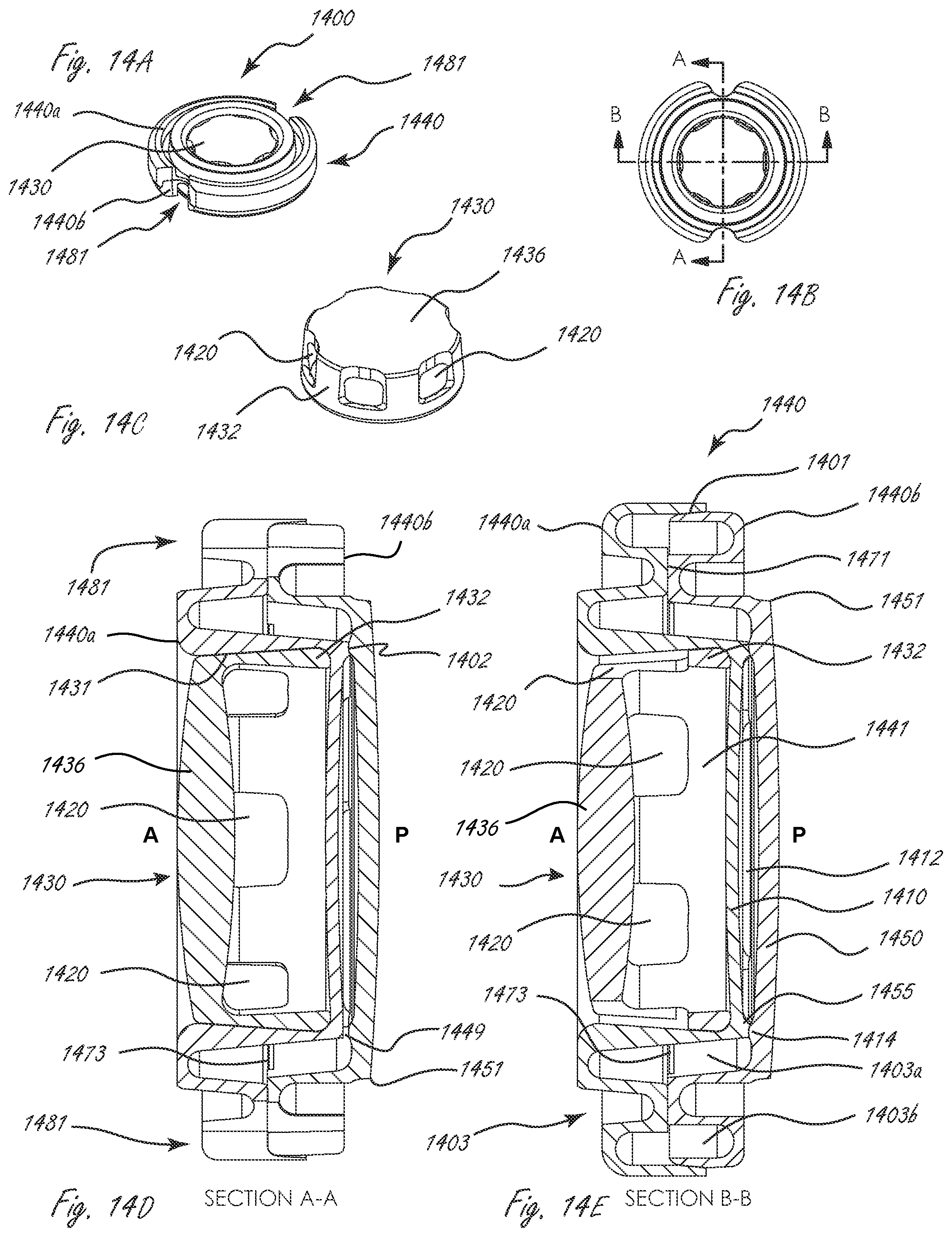 Patent US12167960 Figure 15 – Multi-piece accommodating intraocular lenses and methods for making and using same