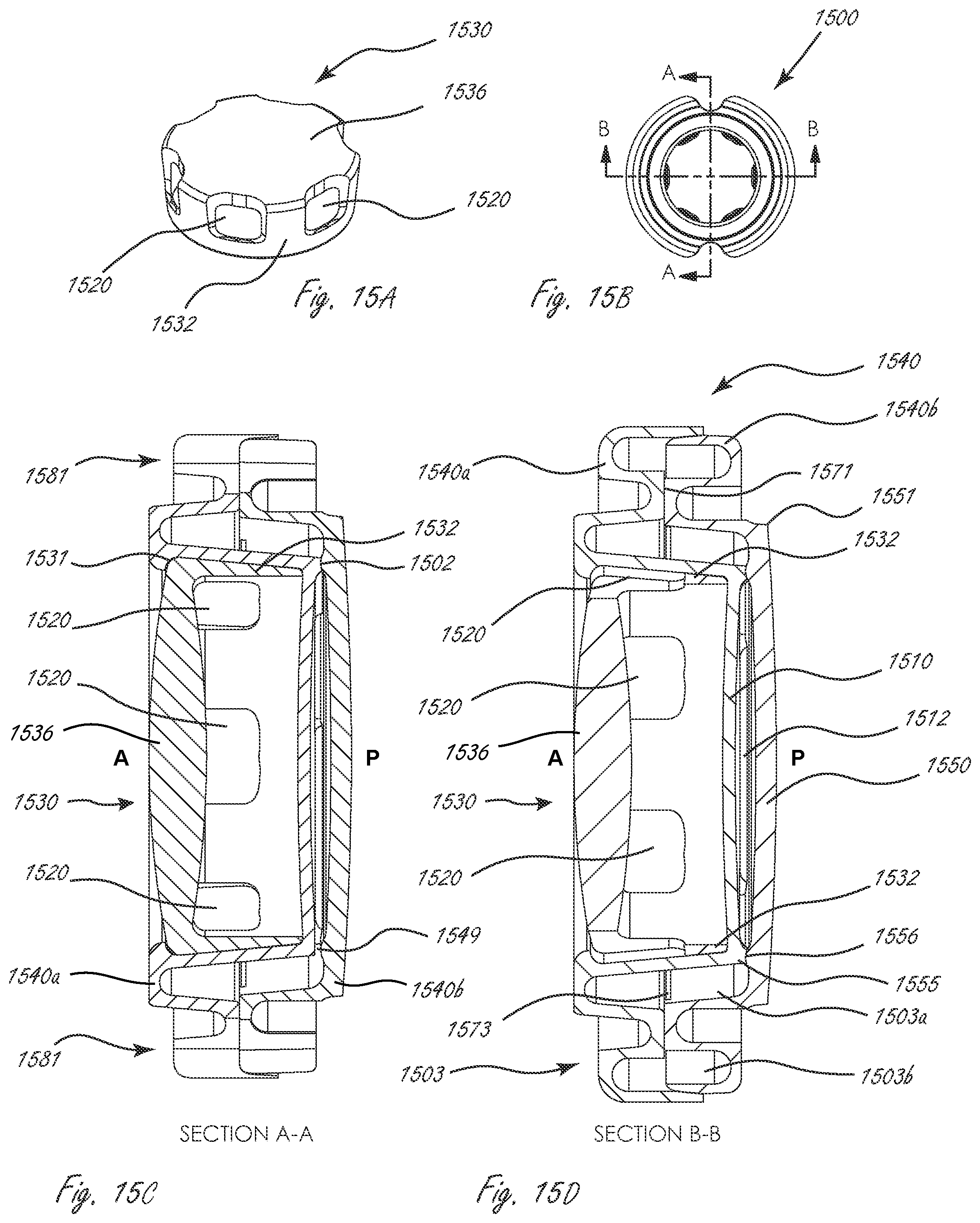 Patent US12167960 Figure 16 – Multi-piece accommodating intraocular lenses and methods for making and using same