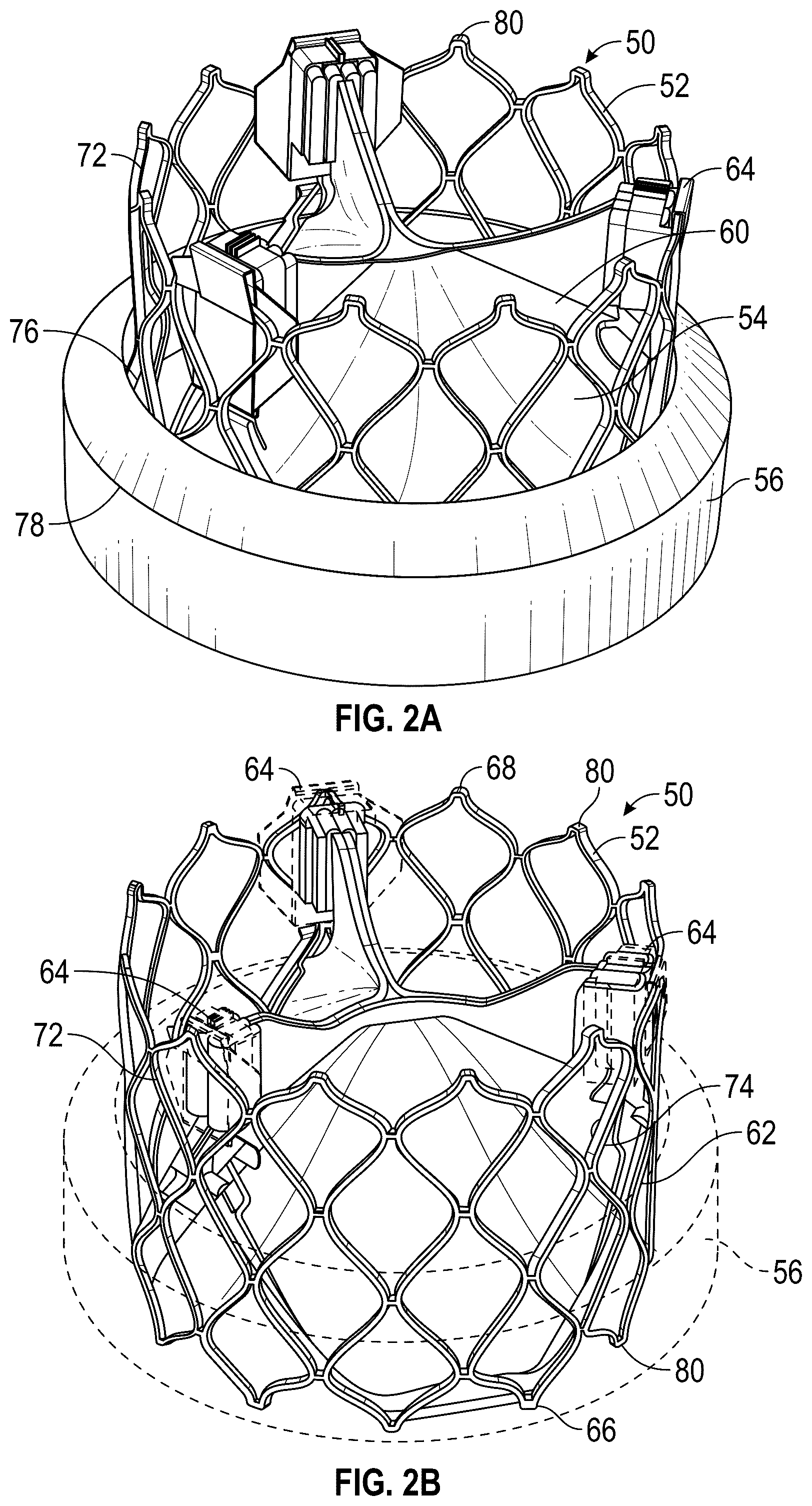 Patent US12167961 Figure 2 – Methods and systems for aligning a commissure of a prosthetic heart valve with a commissure of a native valve