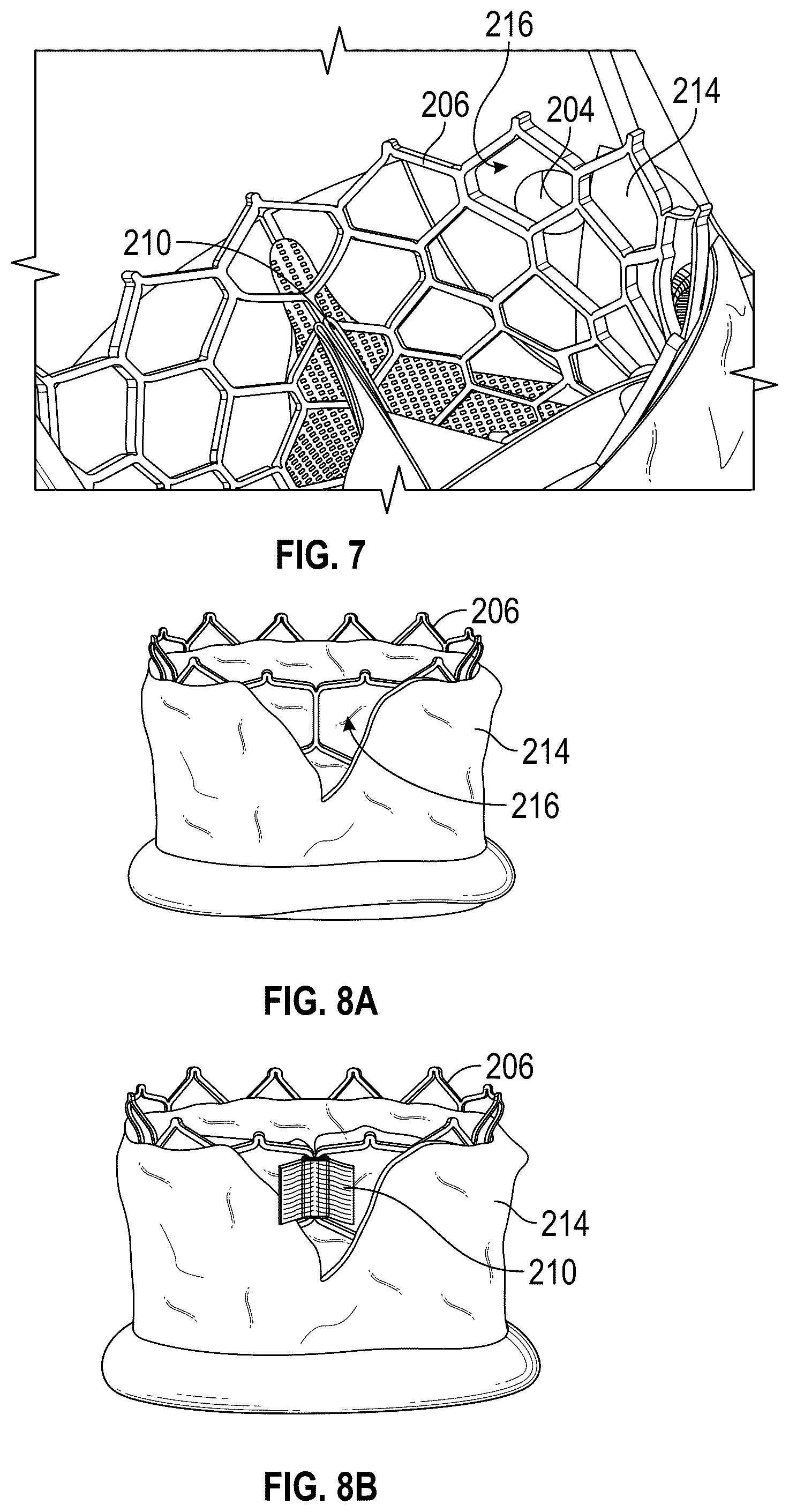 Patent US12167961 Figure 6 – Methods and systems for aligning a commissure of a prosthetic heart valve with a commissure of a native valve