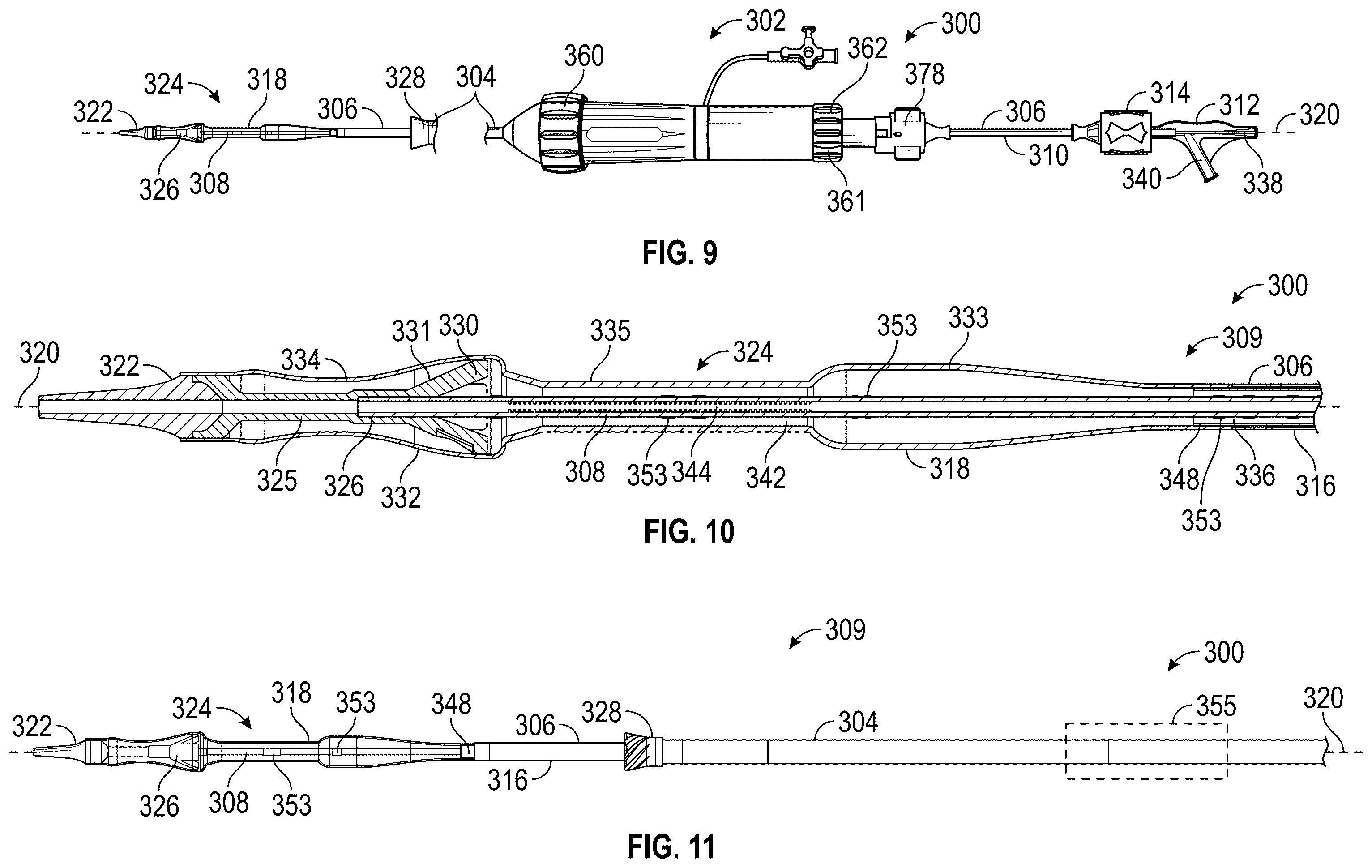 Patent US12167961 Figure 7 – Methods and systems for aligning a commissure of a prosthetic heart valve with a commissure of a native valve