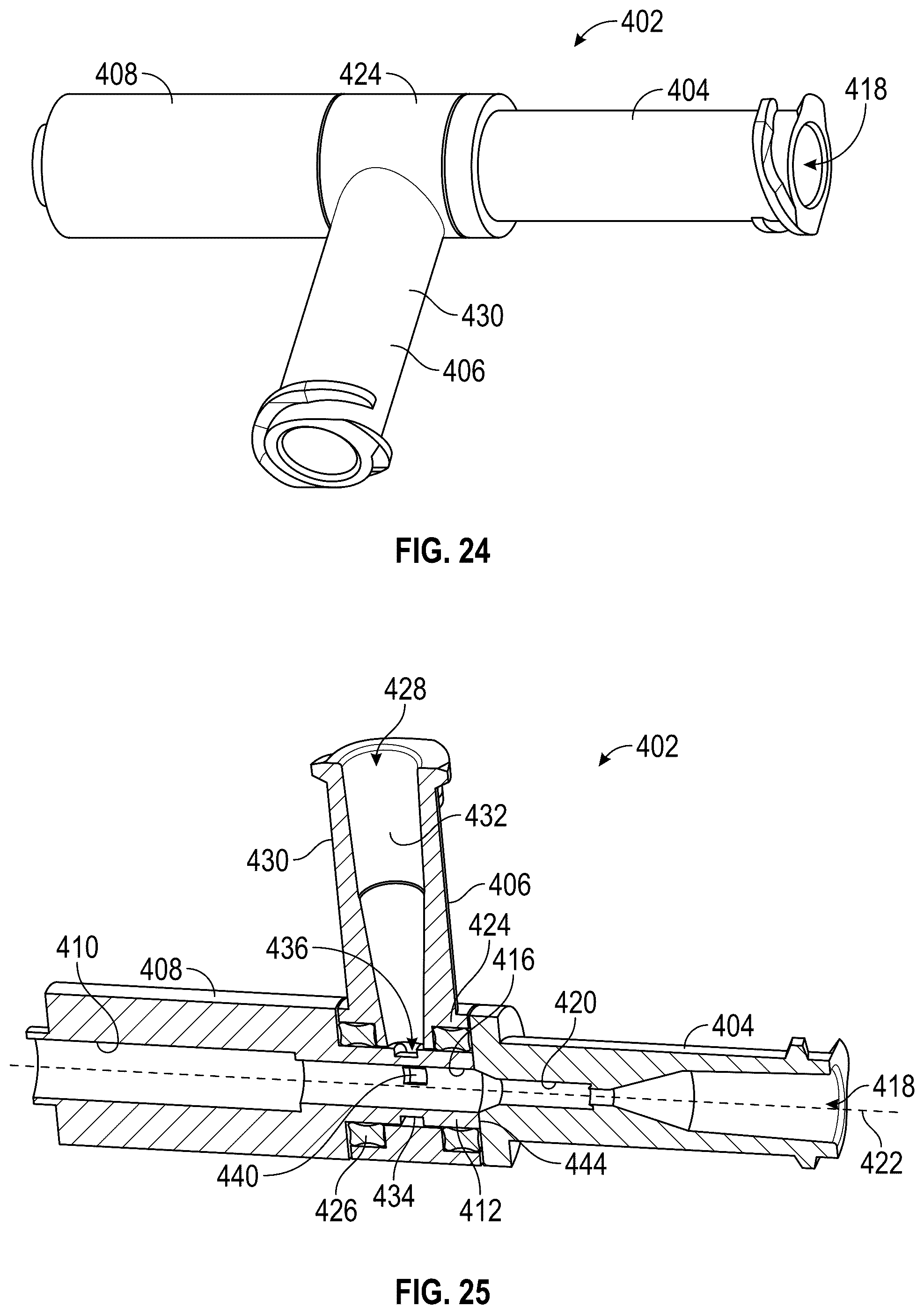 Patent US12167961 Figure 15 – Methods and systems for aligning a commissure of a prosthetic heart valve with a commissure of a native valve