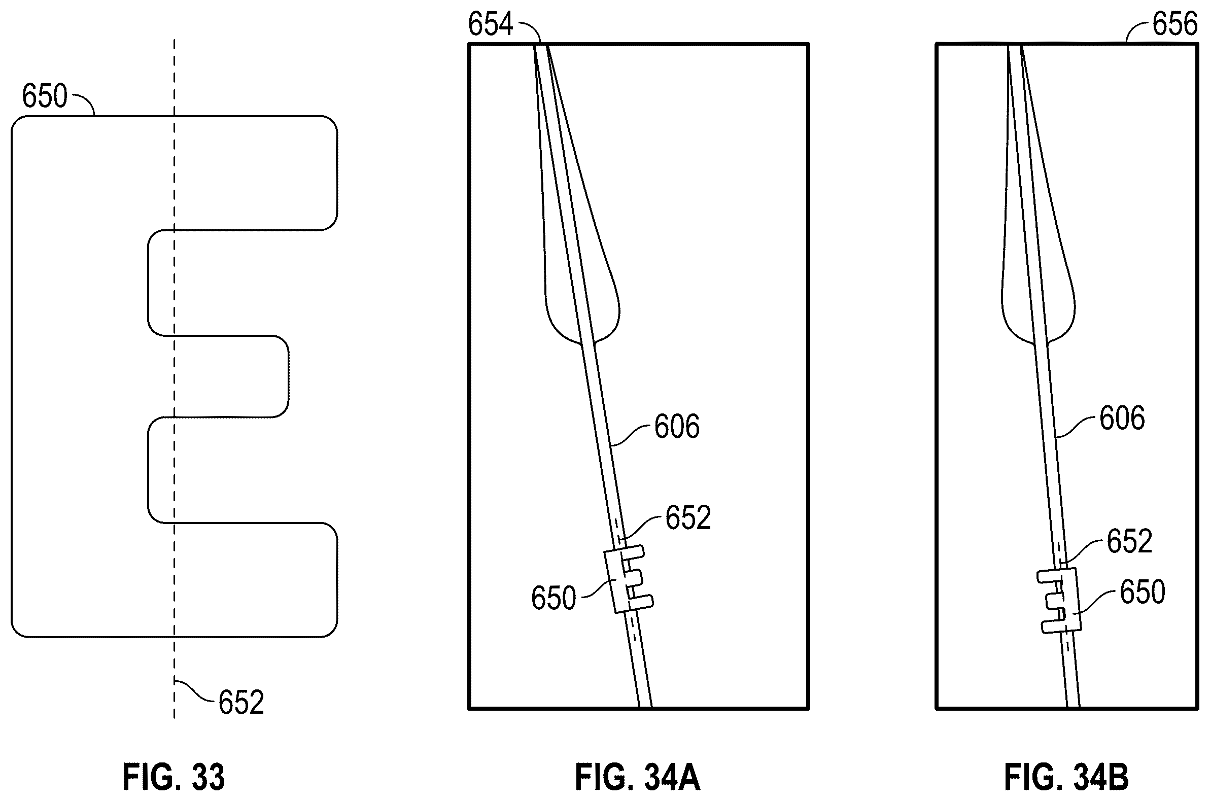 Patent US12167961 Figure 20 – Methods and systems for aligning a commissure of a prosthetic heart valve with a commissure of a native valve