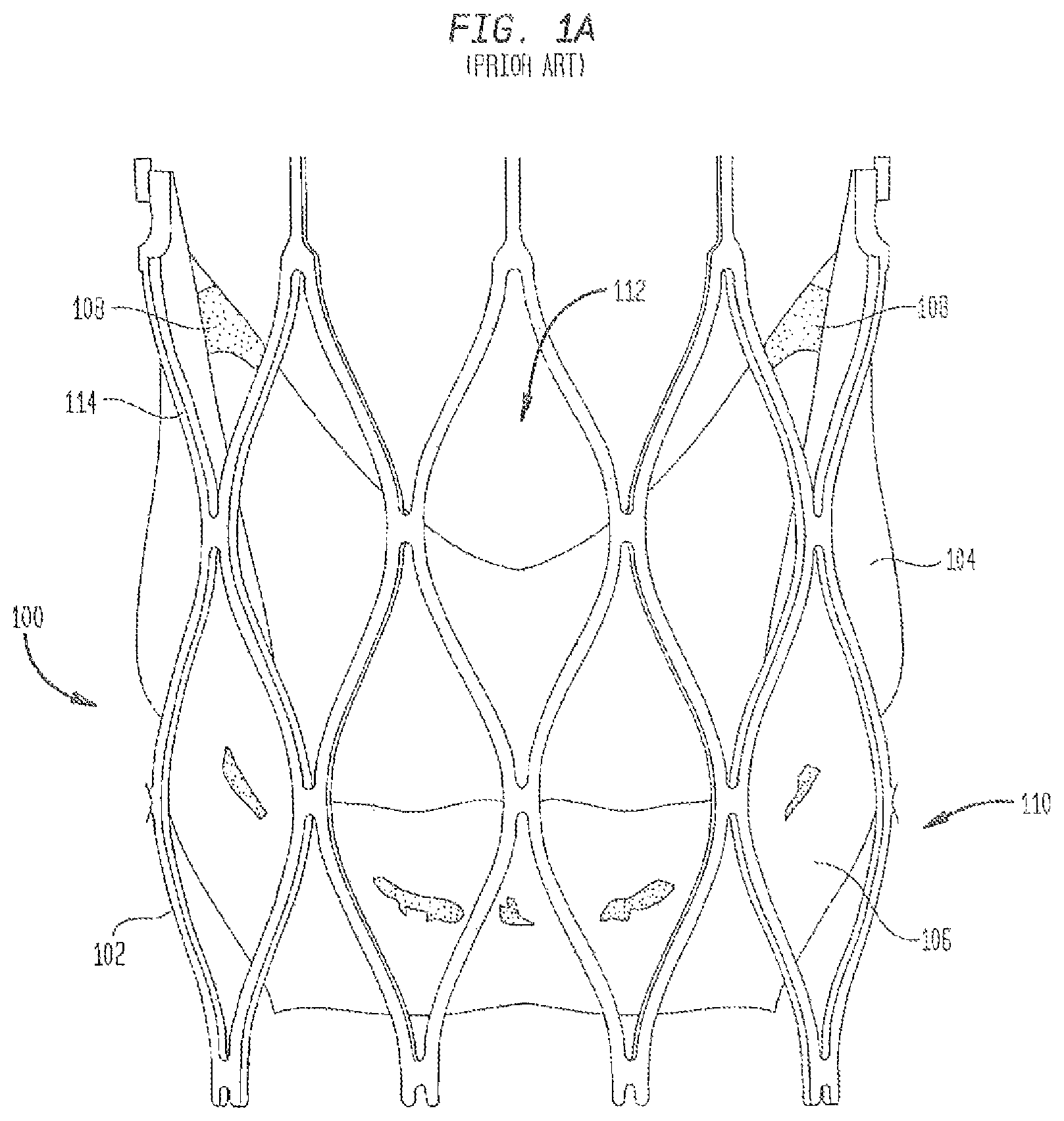 Patent US12167962 Figure 1 – Valve leaflet attachment in collapsible prosthetic valves
