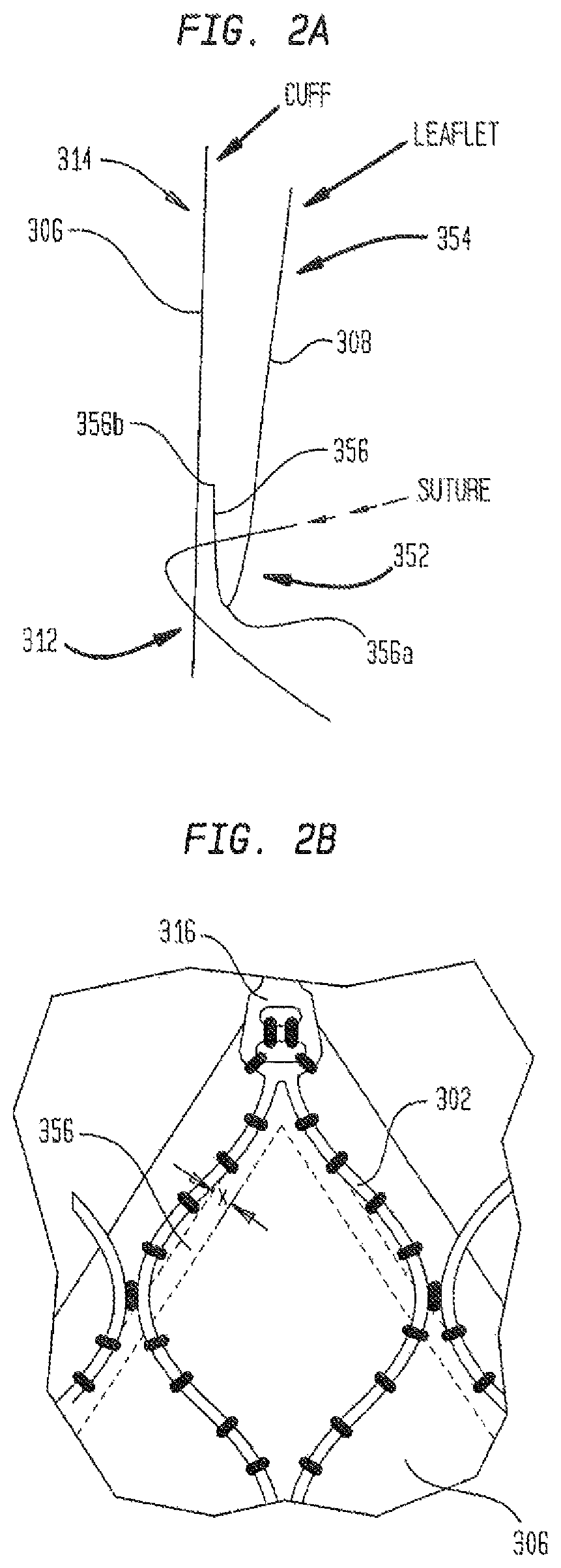 Patent US12167962 Figure 3 – Valve leaflet attachment in collapsible prosthetic valves