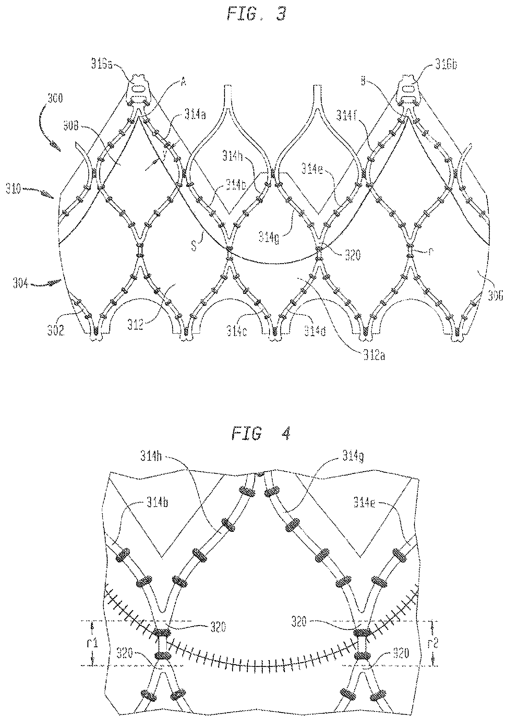 Patent US12167962 Figure 4 – Valve leaflet attachment in collapsible prosthetic valves