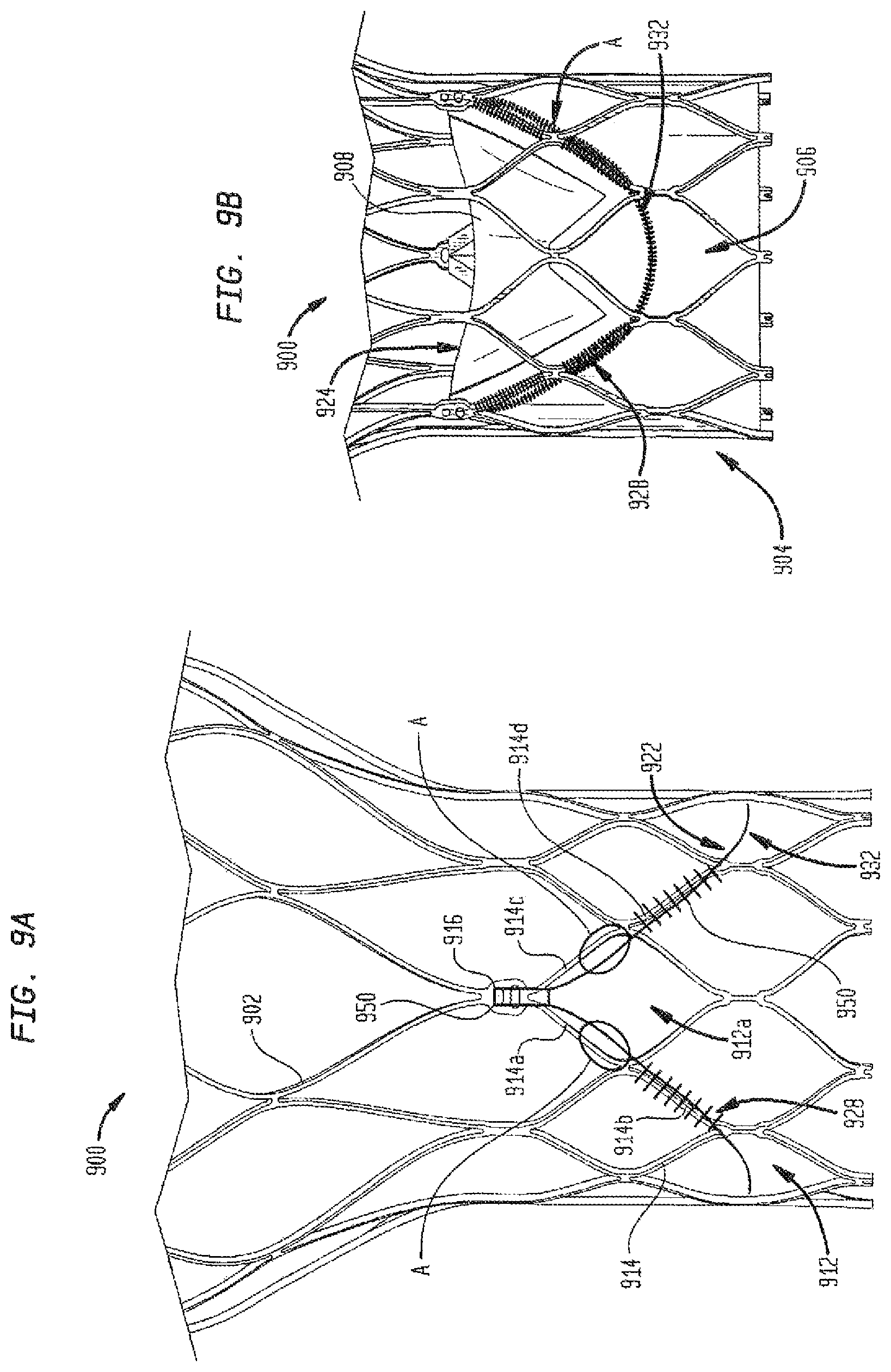 Patent US12167962 Figure 9 – Valve leaflet attachment in collapsible prosthetic valves