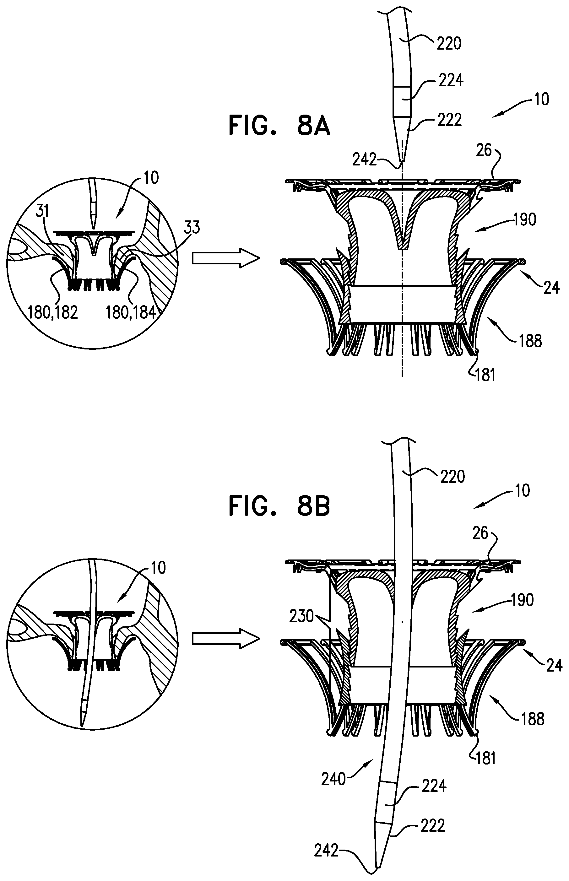 Patent US12167963 Figure 14 – Method for use at a heart valve