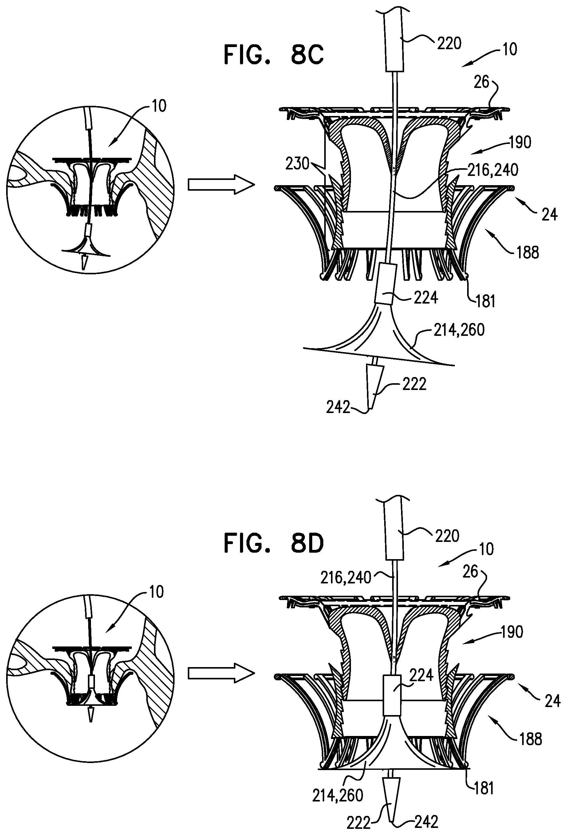 Patent US12167963 Figure 15 – Method for use at a heart valve