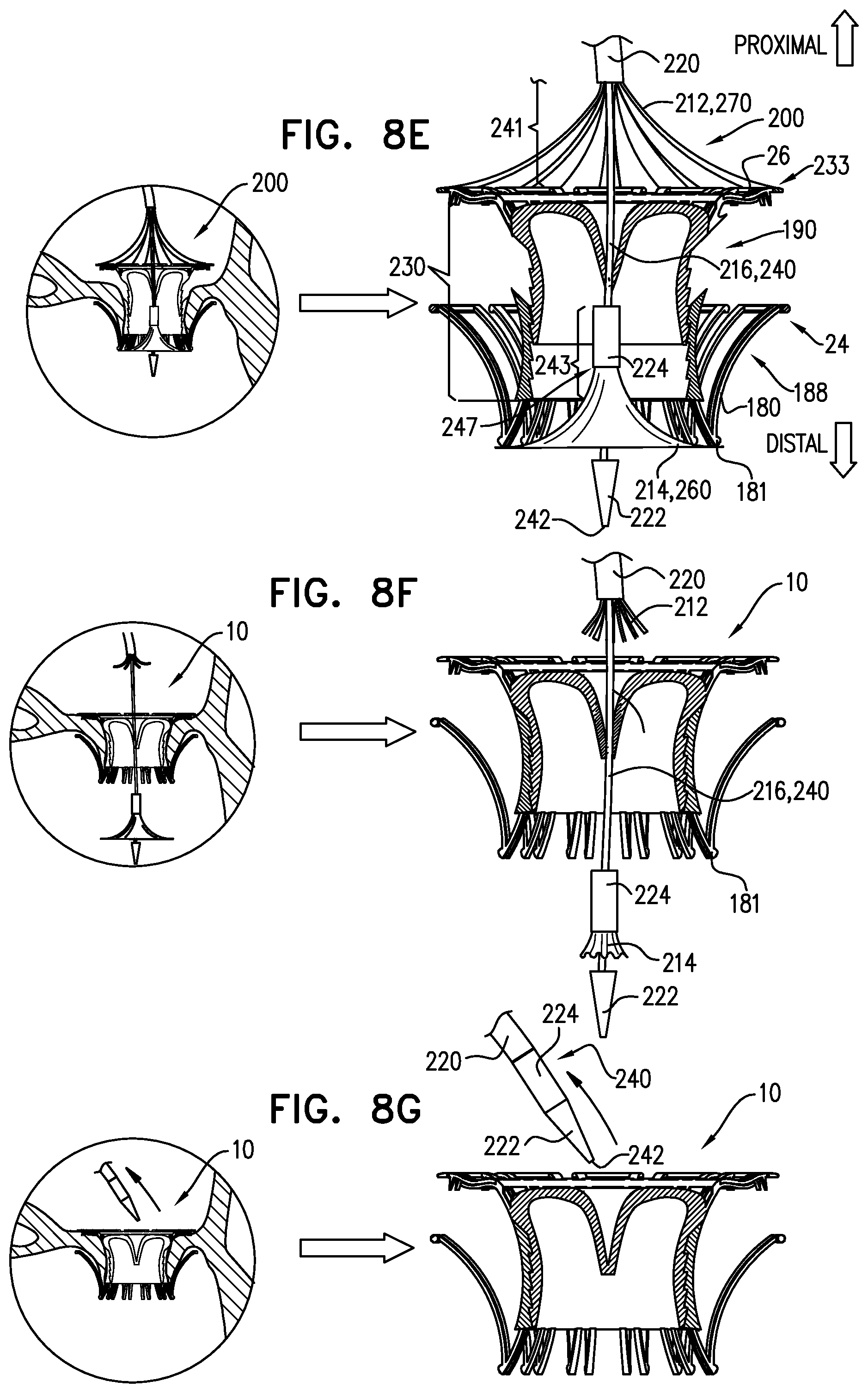 Patent US12167963 Figure 16 – Method for use at a heart valve
