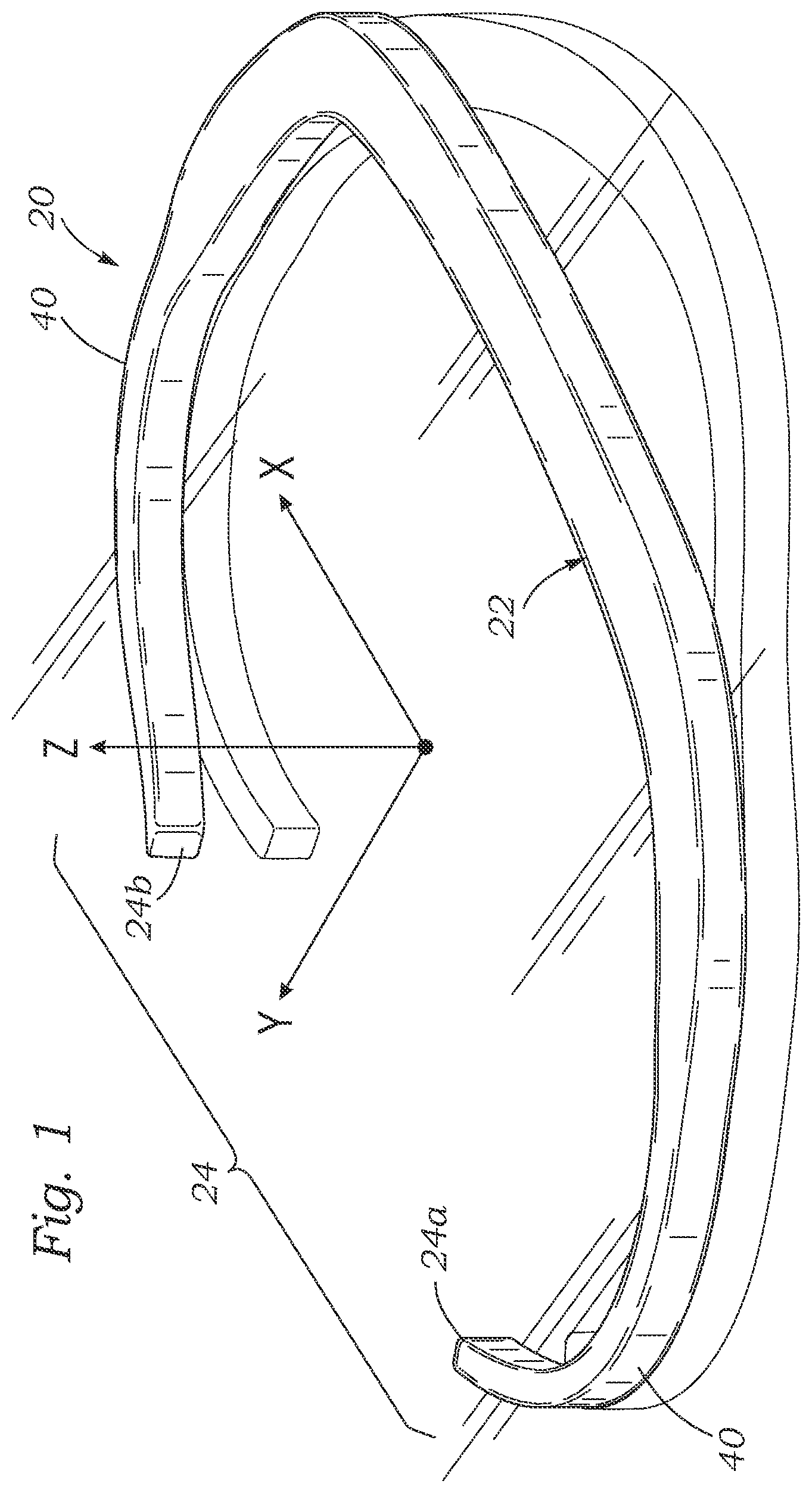 Patent US12167964 Figure 1 – Minimally-invasive low strain annuloplasty ring