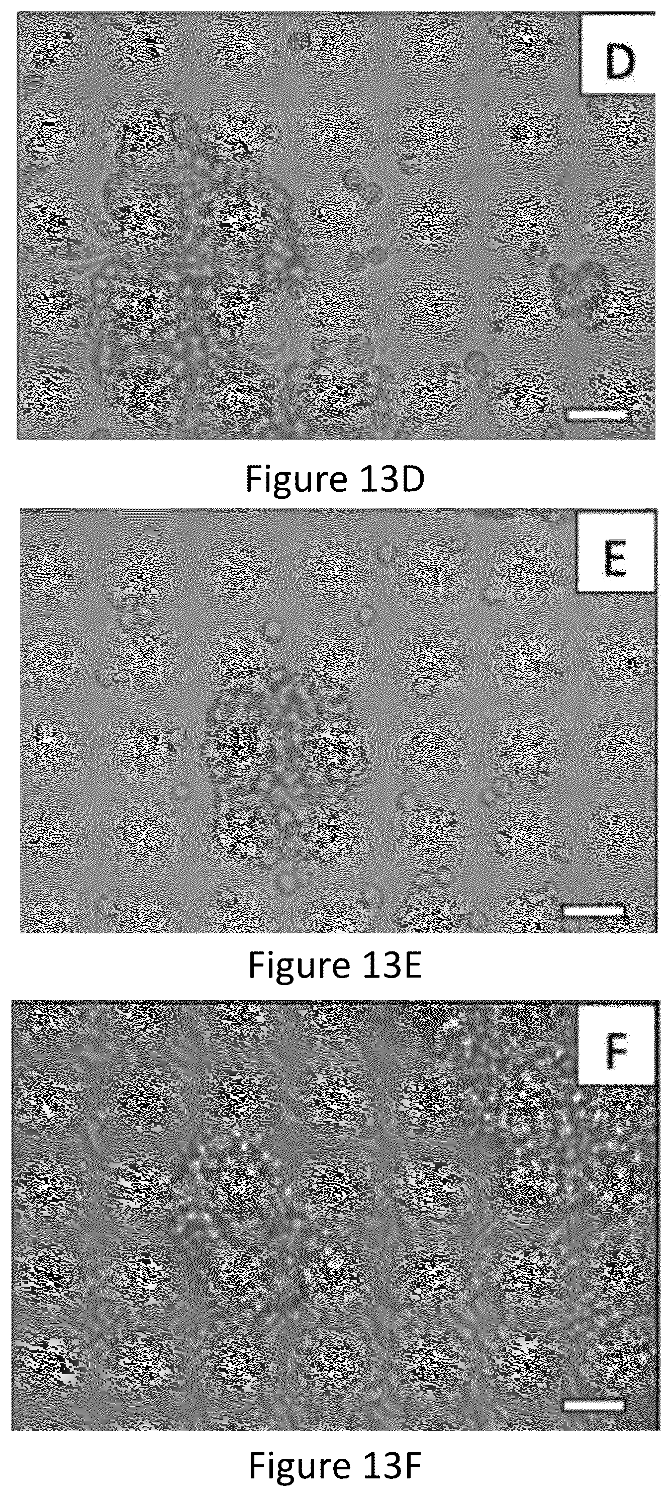 Patent US12167965 Figure 16 – Liquid collagen bioinks and methods to make and use collagen structures