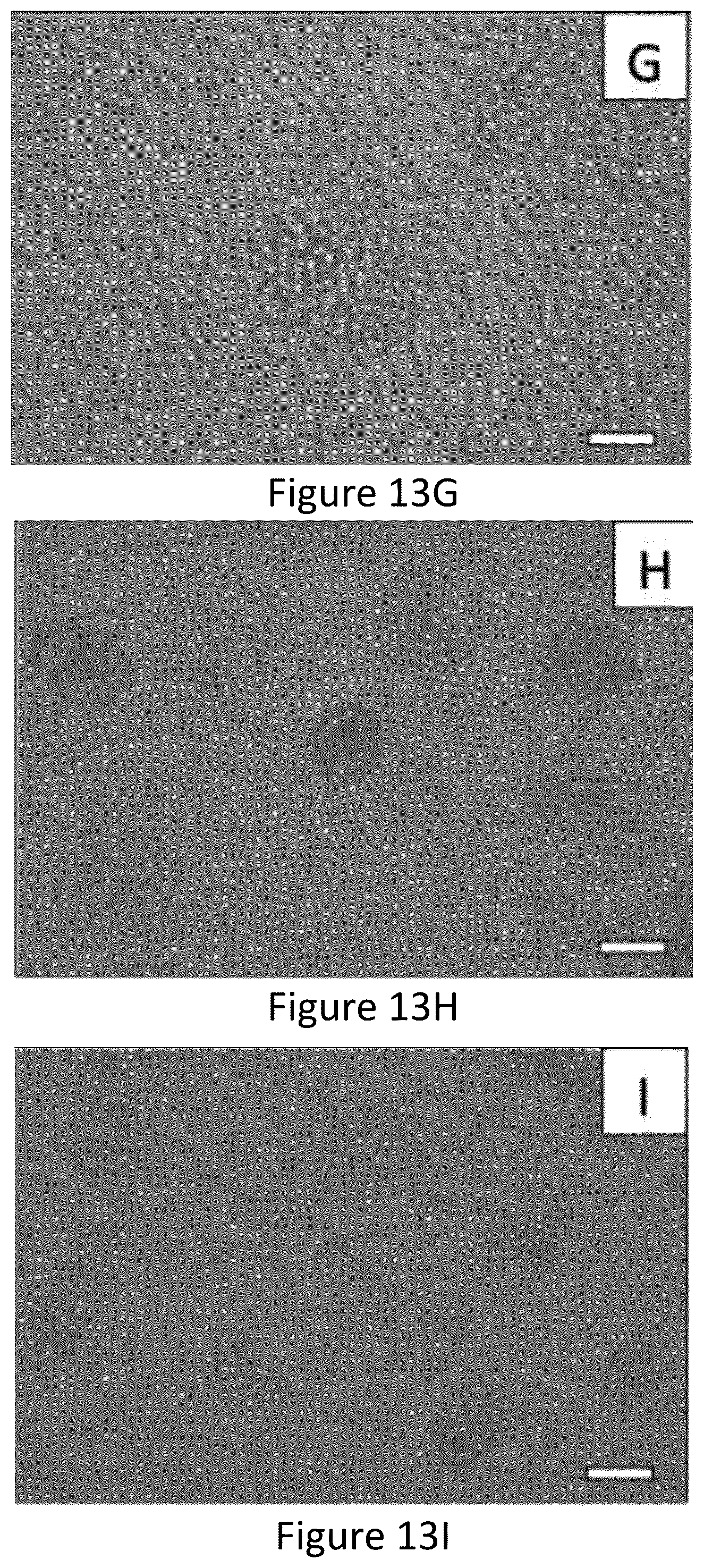 Patent US12167965 Figure 17 – Liquid collagen bioinks and methods to make and use collagen structures