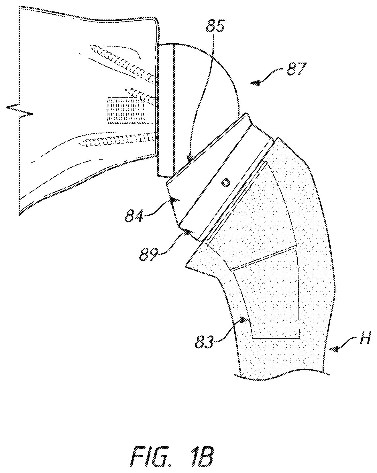 Patent US12167966 Figure 2 – Shoulder prosthesis components and assemblies
