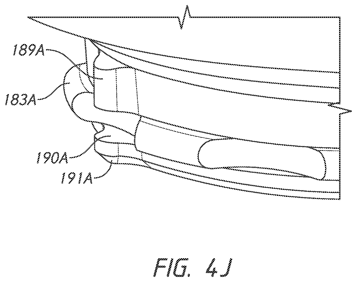 Patent US12167966 Figure 12 – Shoulder prosthesis components and assemblies