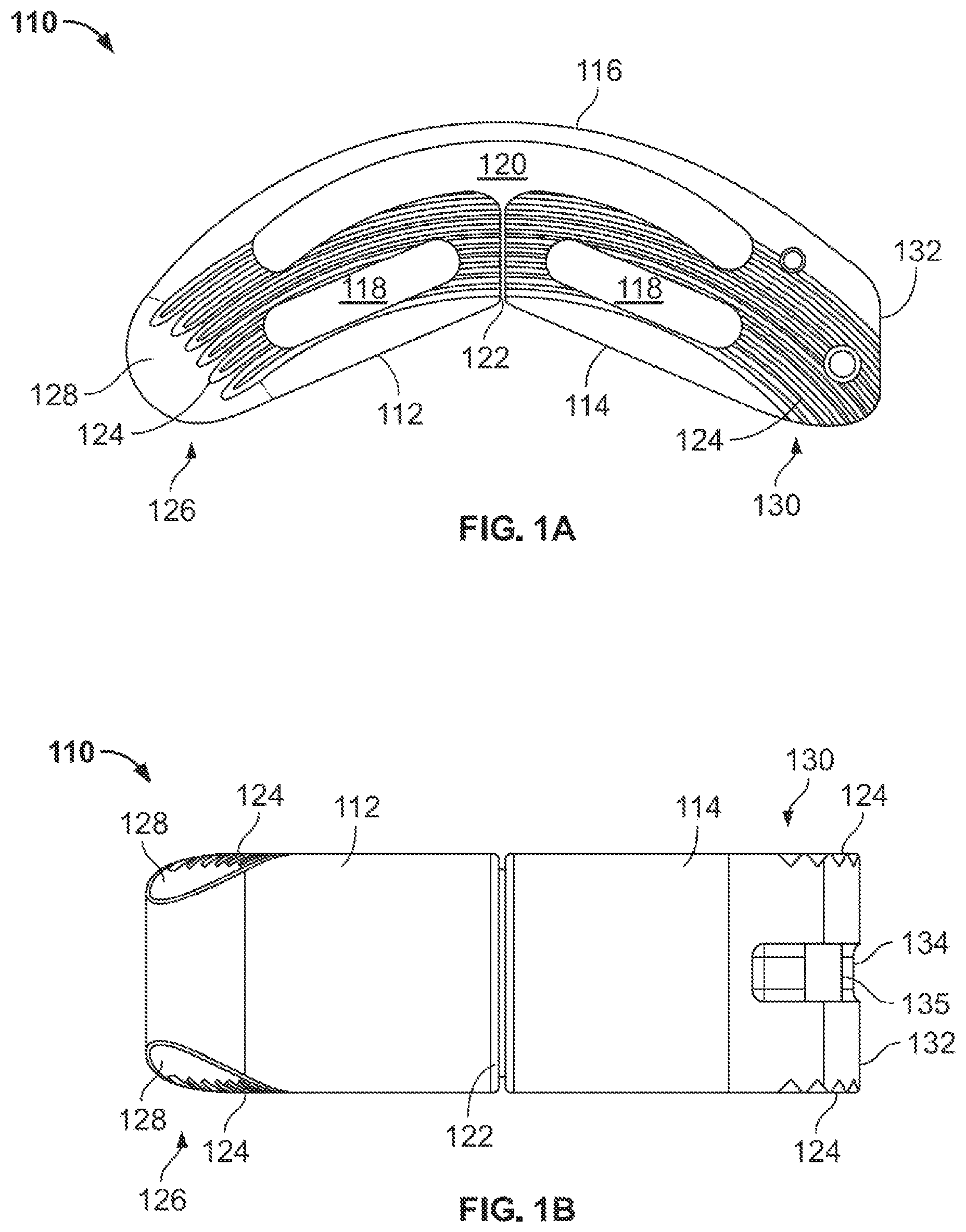 Patent US12167967 Figure 1 – Flexible interbody implant