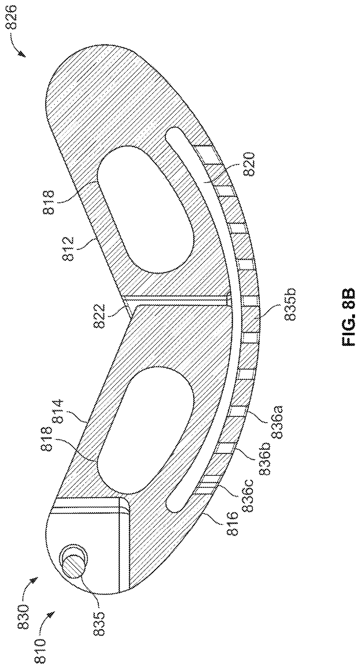 Patent US12167967 Figure 10 – Flexible interbody implant