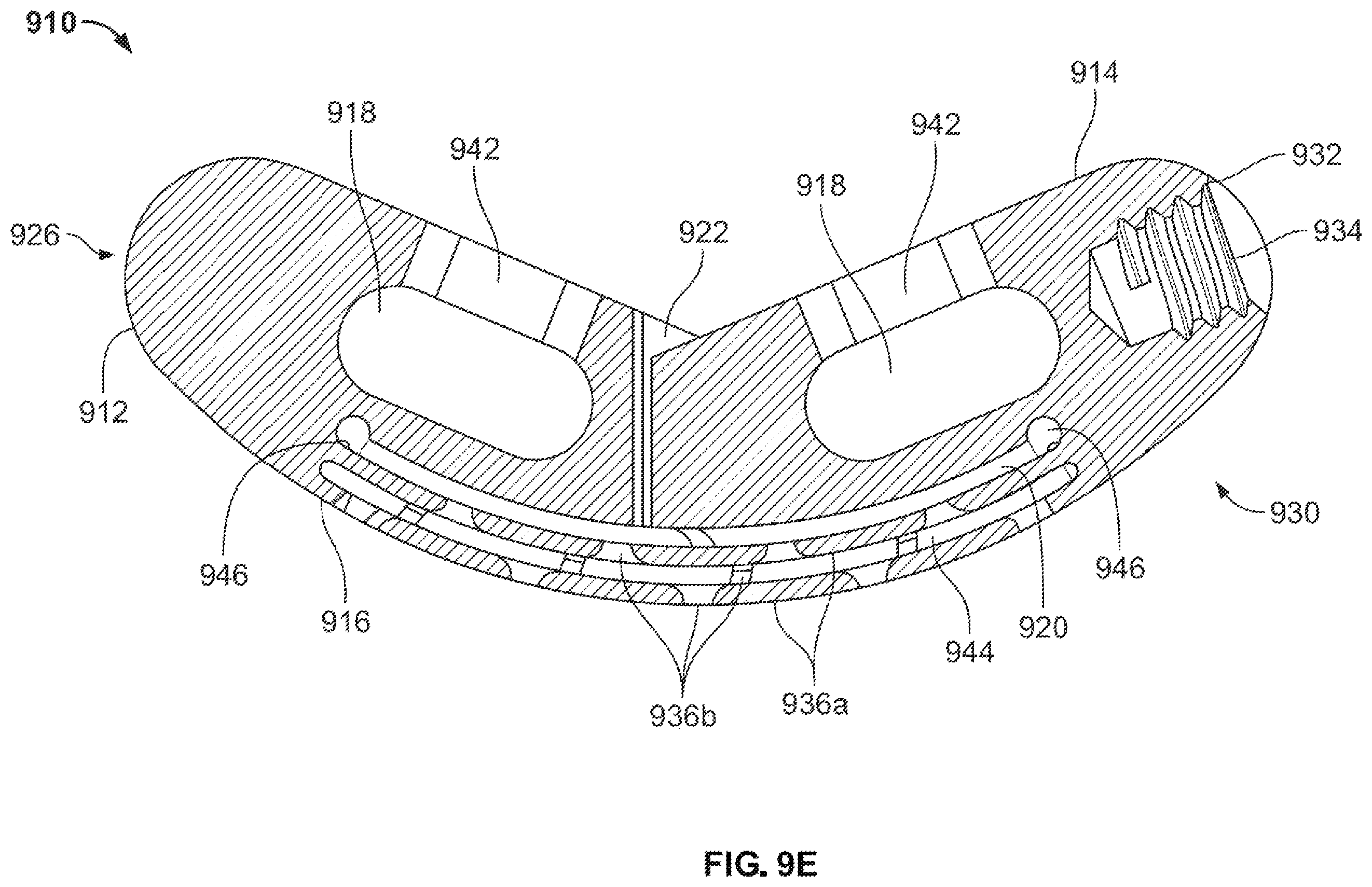 Patent US12167967 Figure 13 – Flexible interbody implant