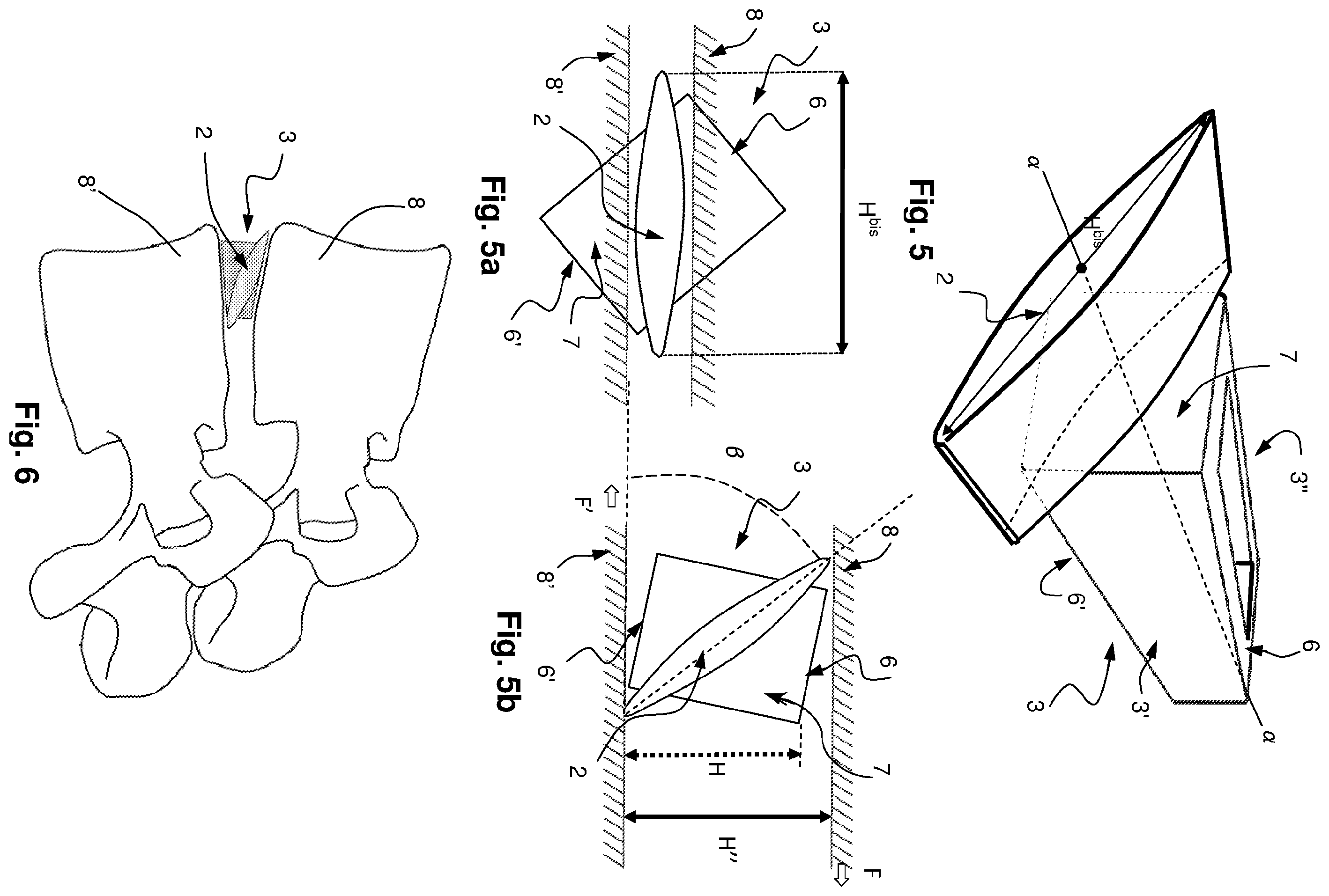 Patent US12167968 Figure 4 – Intersomatic cage