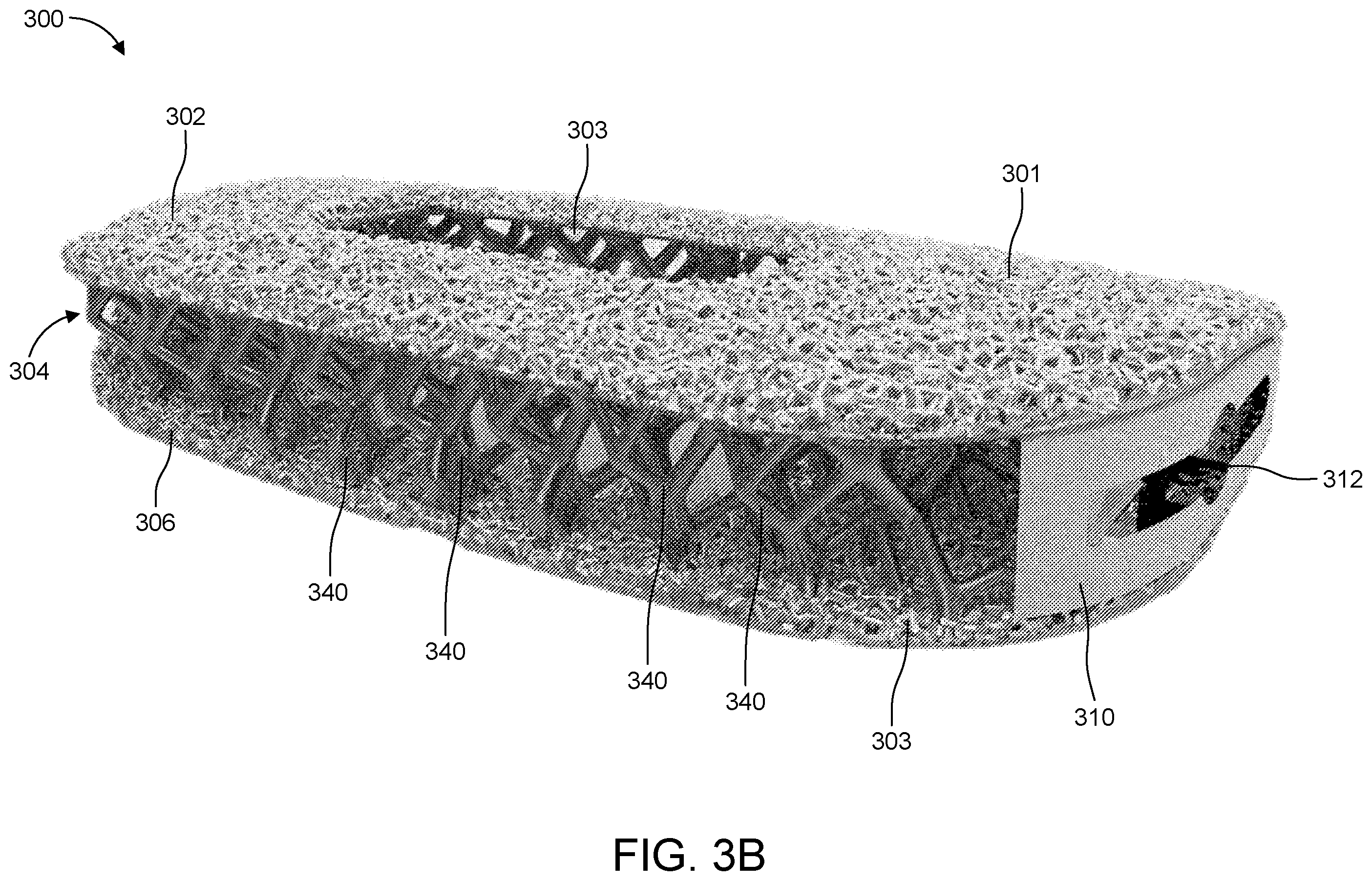 Patent US12167969 Figure 4 – Resonating implant systems and methods