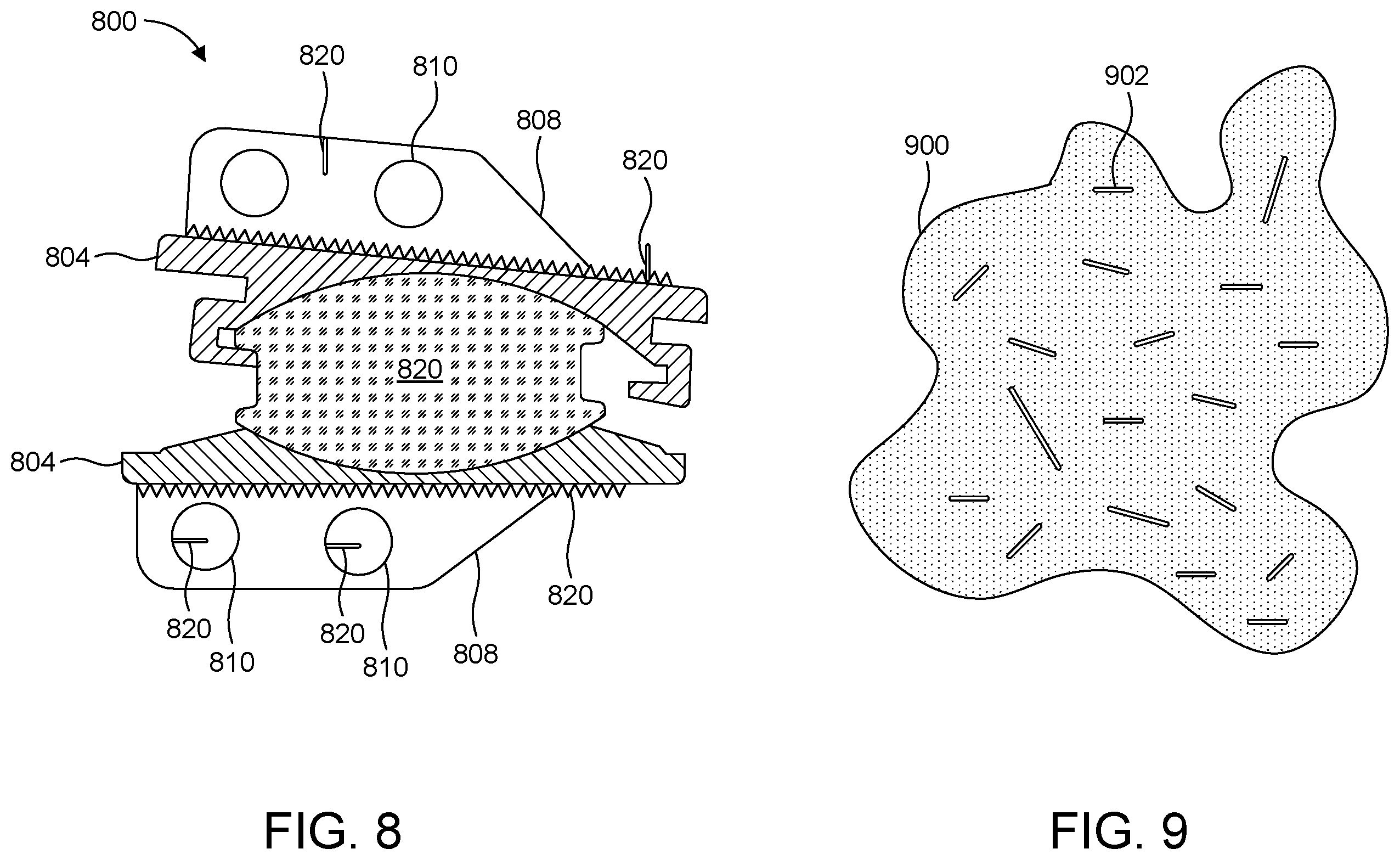Patent US12167969 Figure 9 – Resonating implant systems and methods