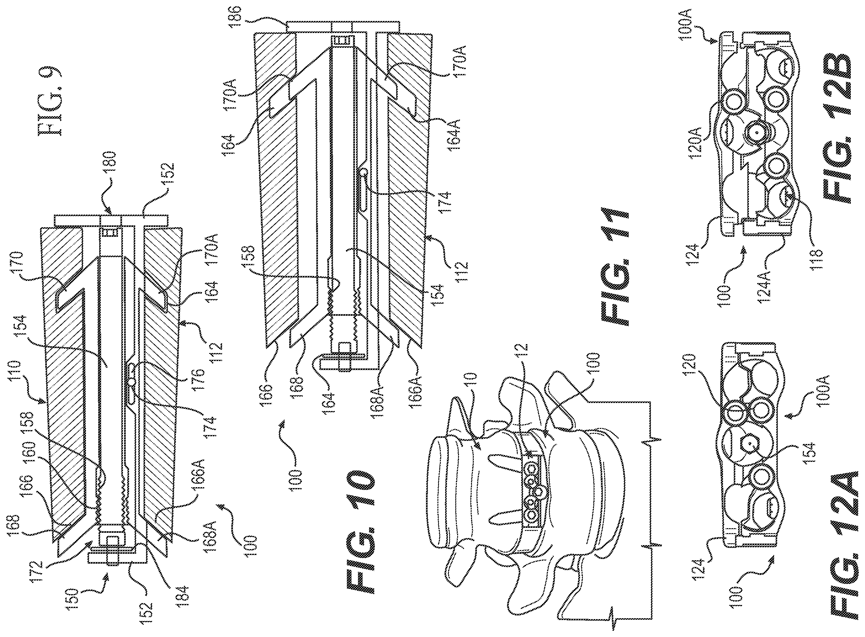 Patent US12167970 Figure 4 – Expandable inter vertebral implant