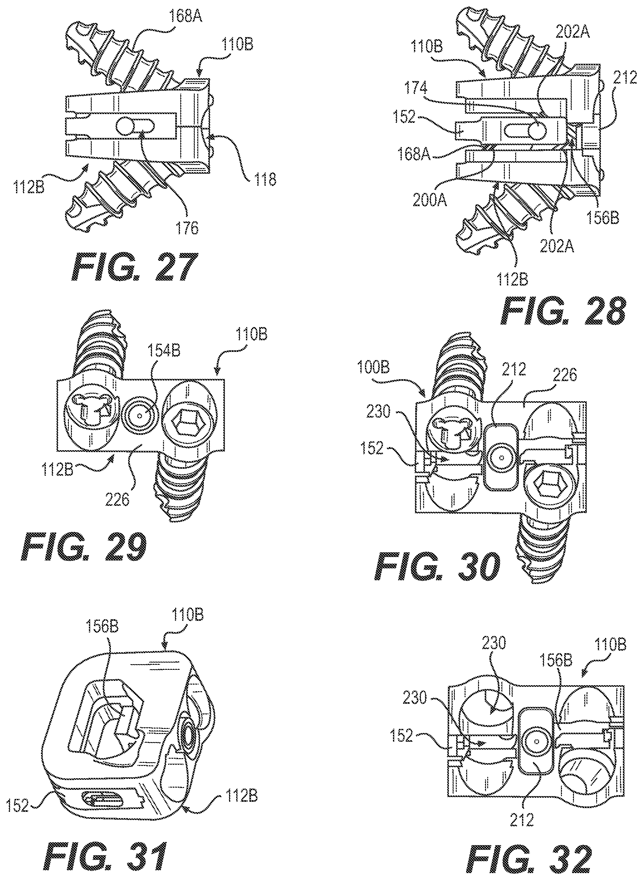 Patent US12167970 Figure 8 – Expandable inter vertebral implant