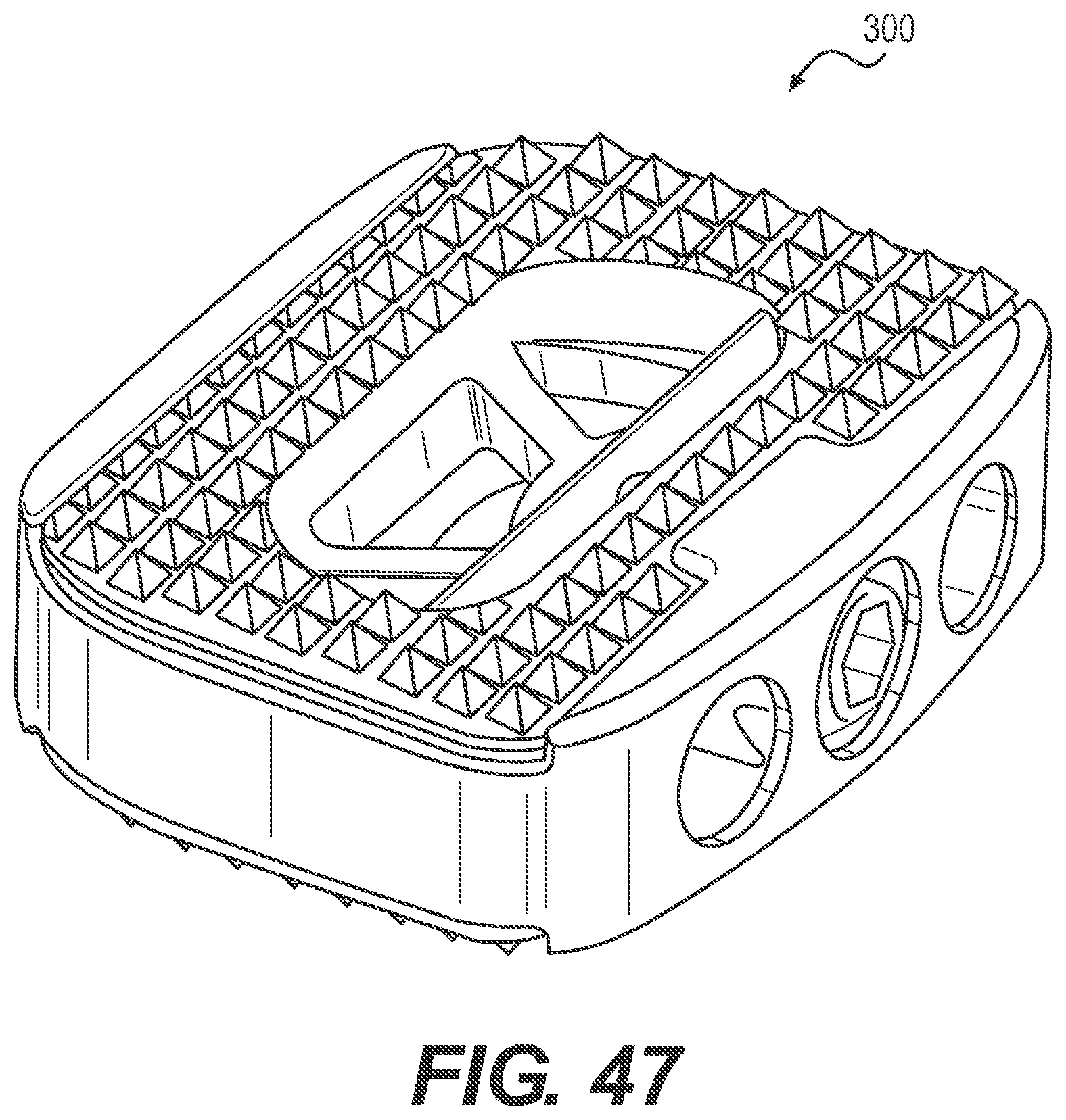 Patent US12167970 Figure 13 – Expandable inter vertebral implant