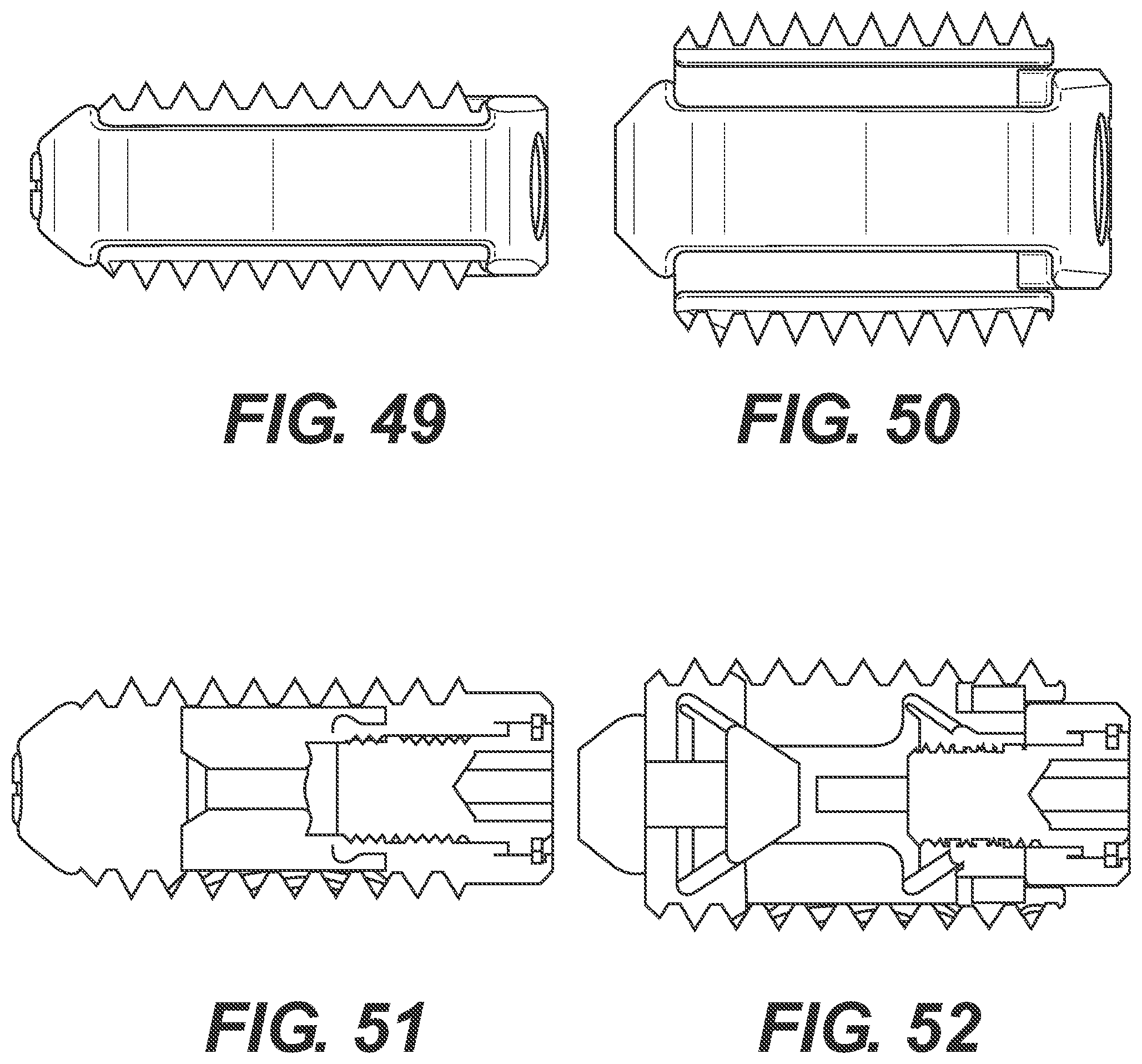 Patent US12167970 Figure 15 – Expandable inter vertebral implant