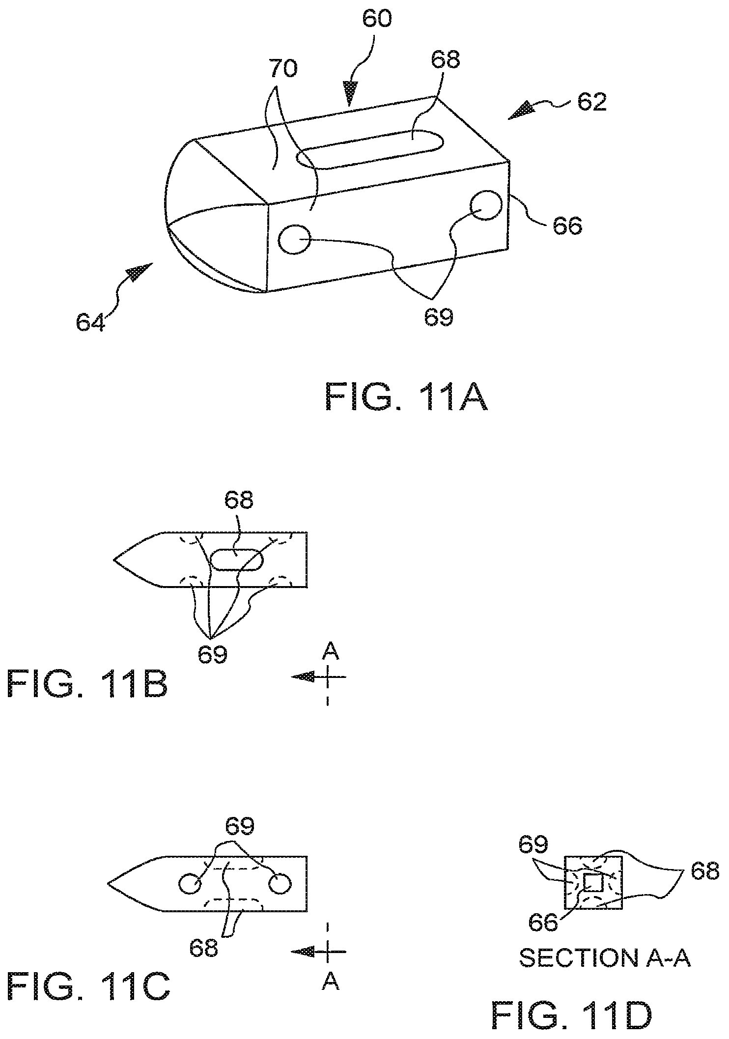 Patent US12167971 Figure 5 – Bone graft delivery devices, systems and kits