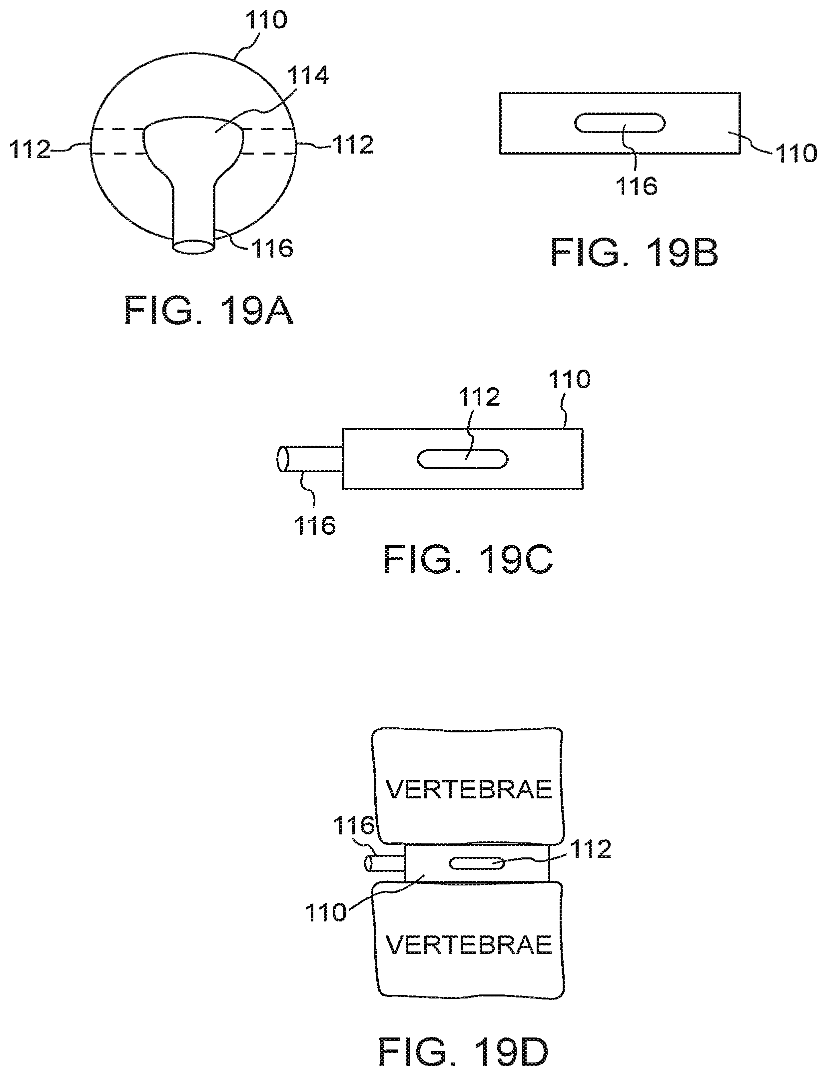 Patent US12167971 Figure 11 – Bone graft delivery devices, systems and kits