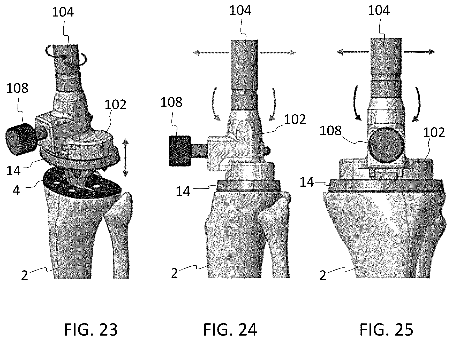 Patent US12167972 Figure 15 – Tibial tray inserter