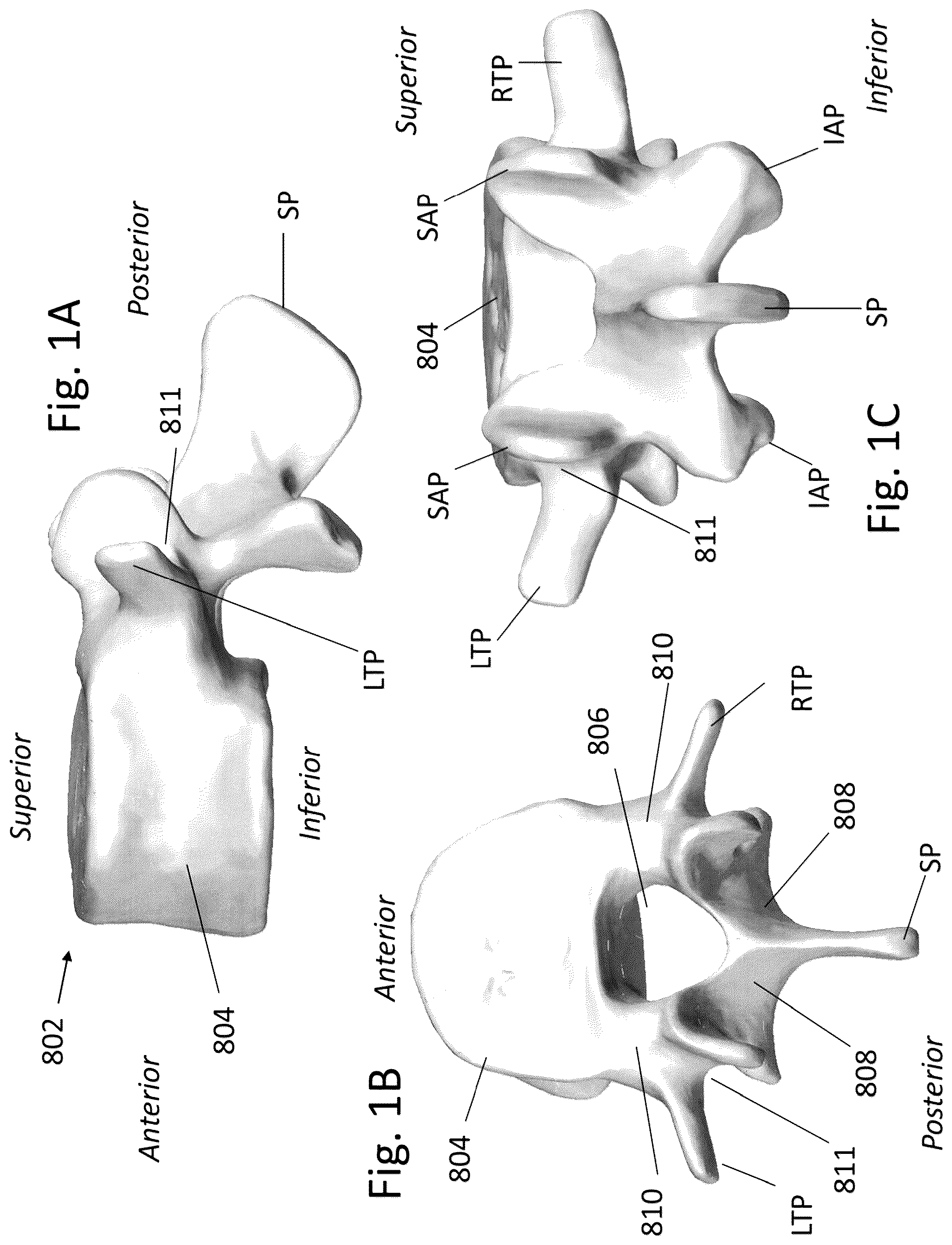 Patent US12167973 Figure 1 – Spinal fixation devices and methods of use
