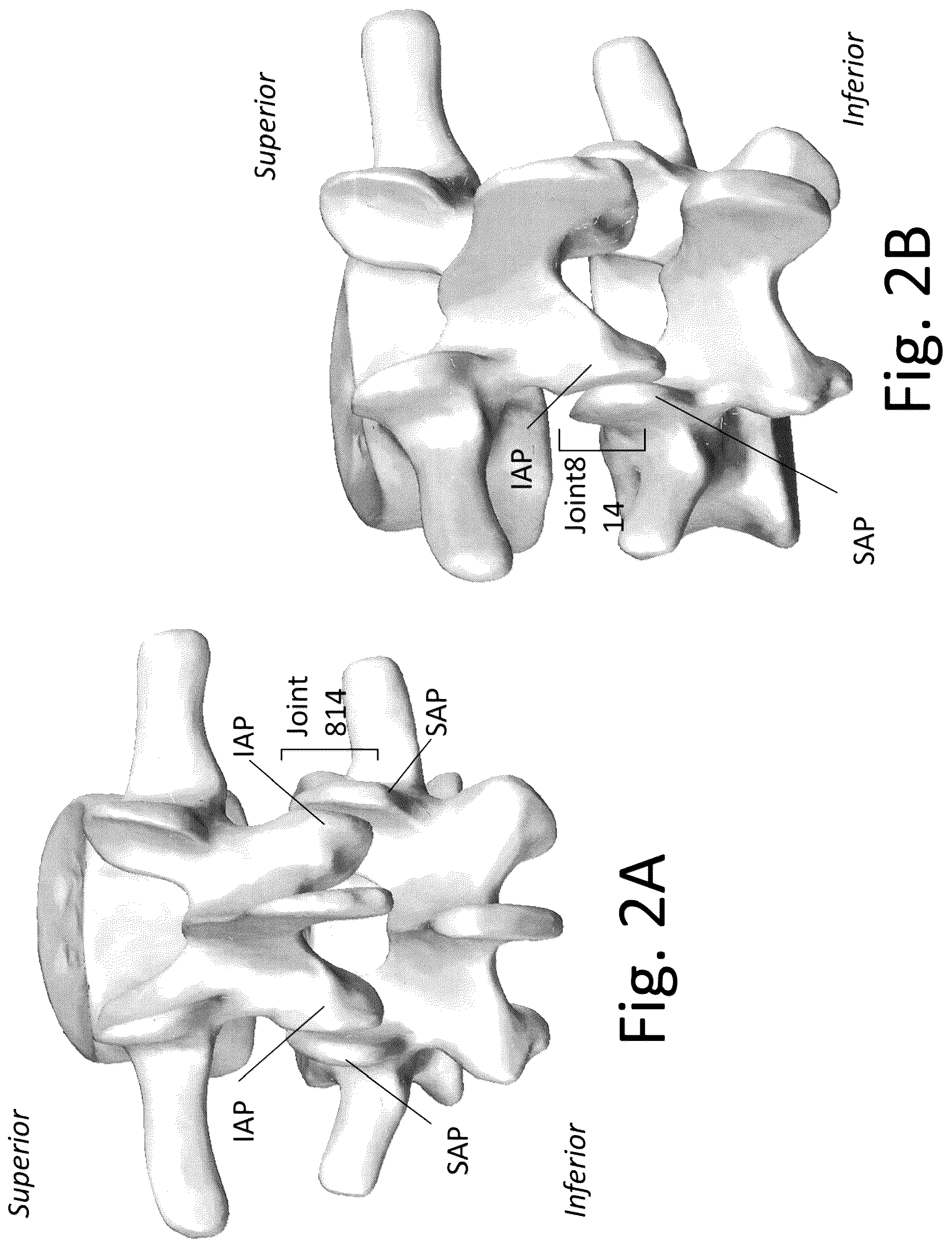 Patent US12167973 Figure 2 – Spinal fixation devices and methods of use