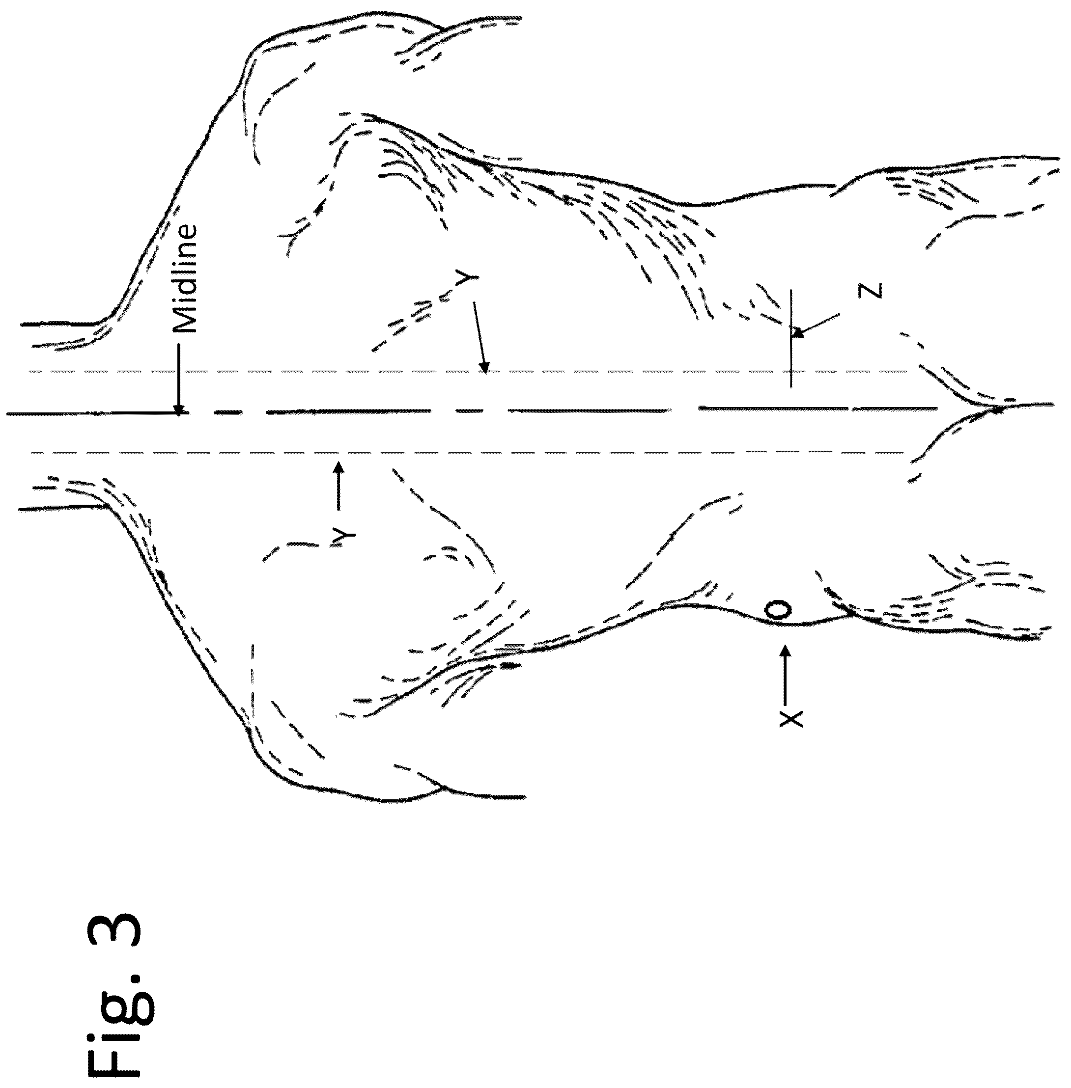 Patent US12167973 Figure 3 – Spinal fixation devices and methods of use
