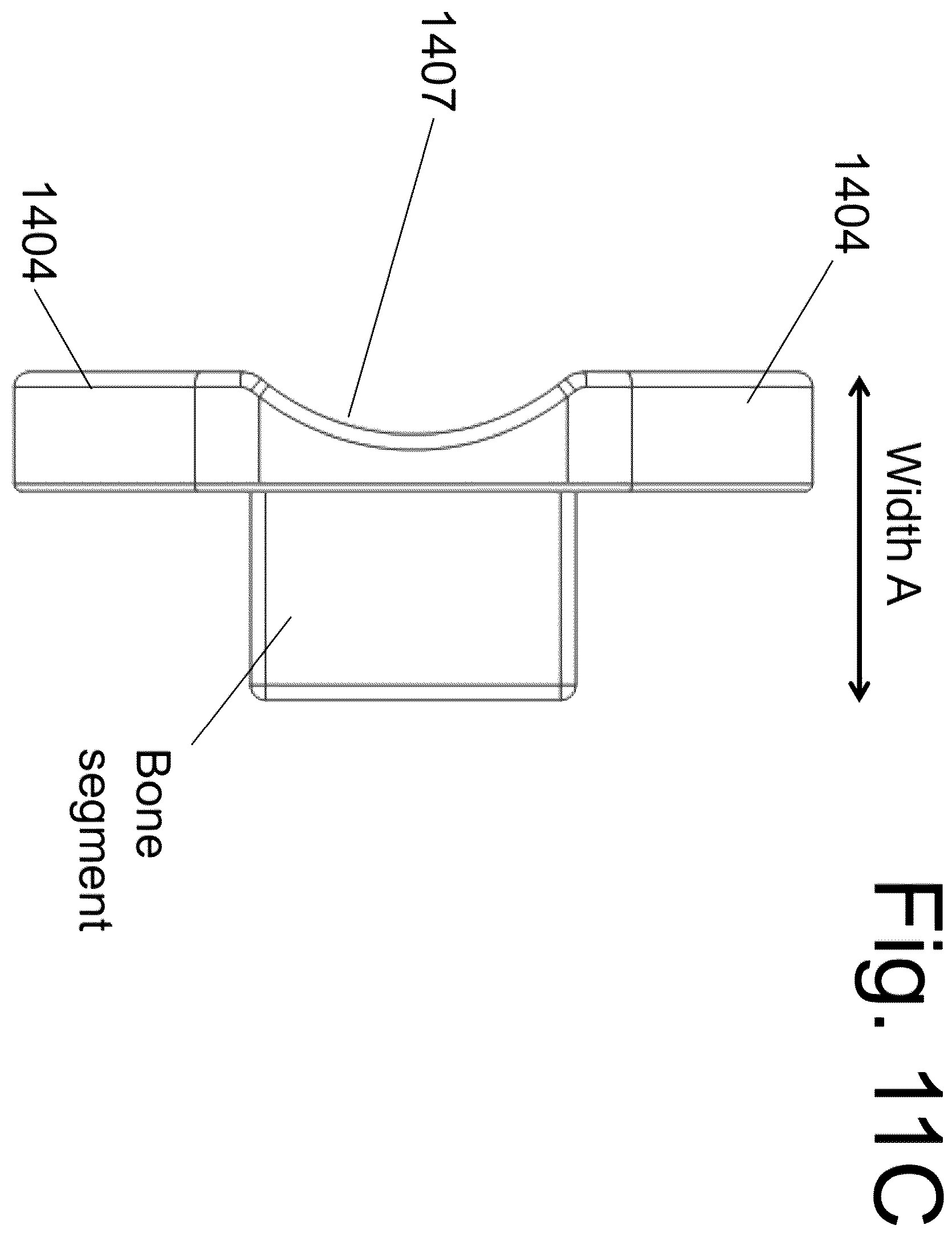 Patent US12167973 Figure 11 – Spinal fixation devices and methods of use