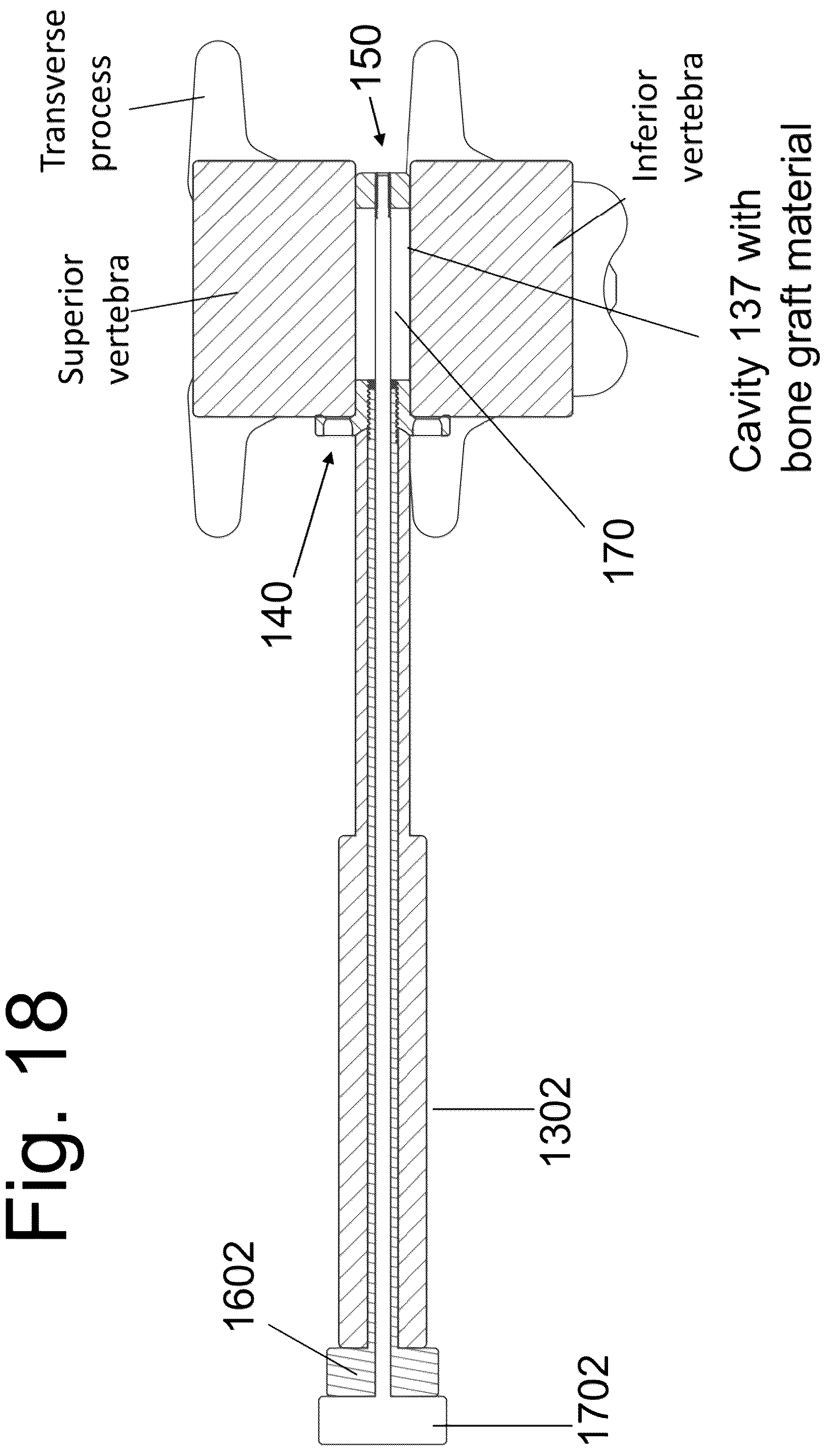 Patent US12167973 Figure 19 – Spinal fixation devices and methods of use