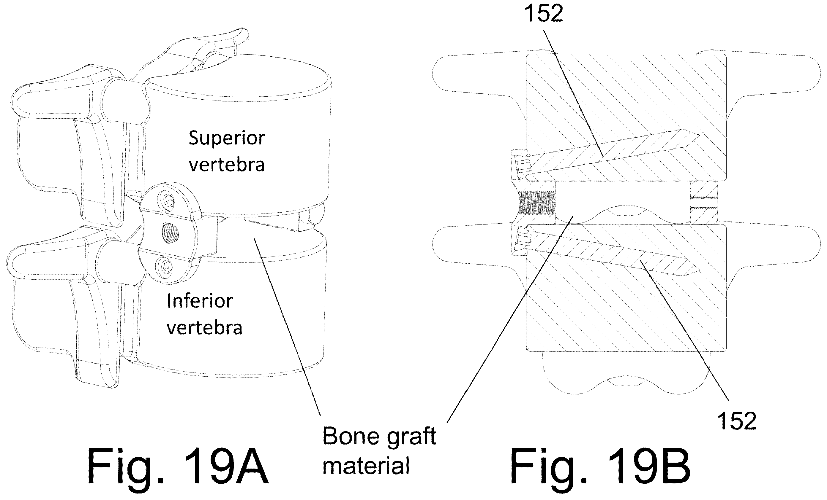 Patent US12167973 Figure 20 – Spinal fixation devices and methods of use