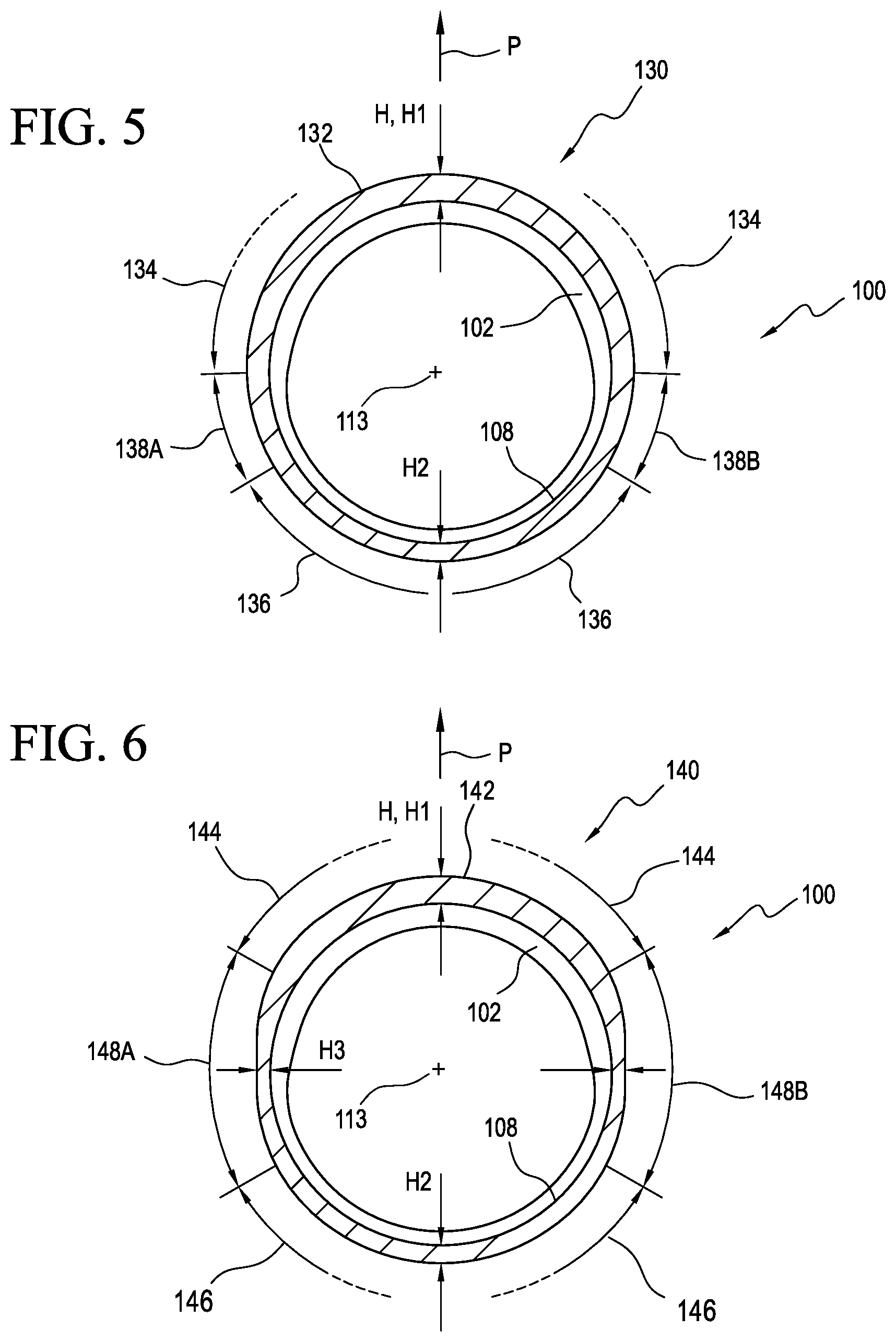 Patent US12167974 Figure 4 – Prosthetic liner