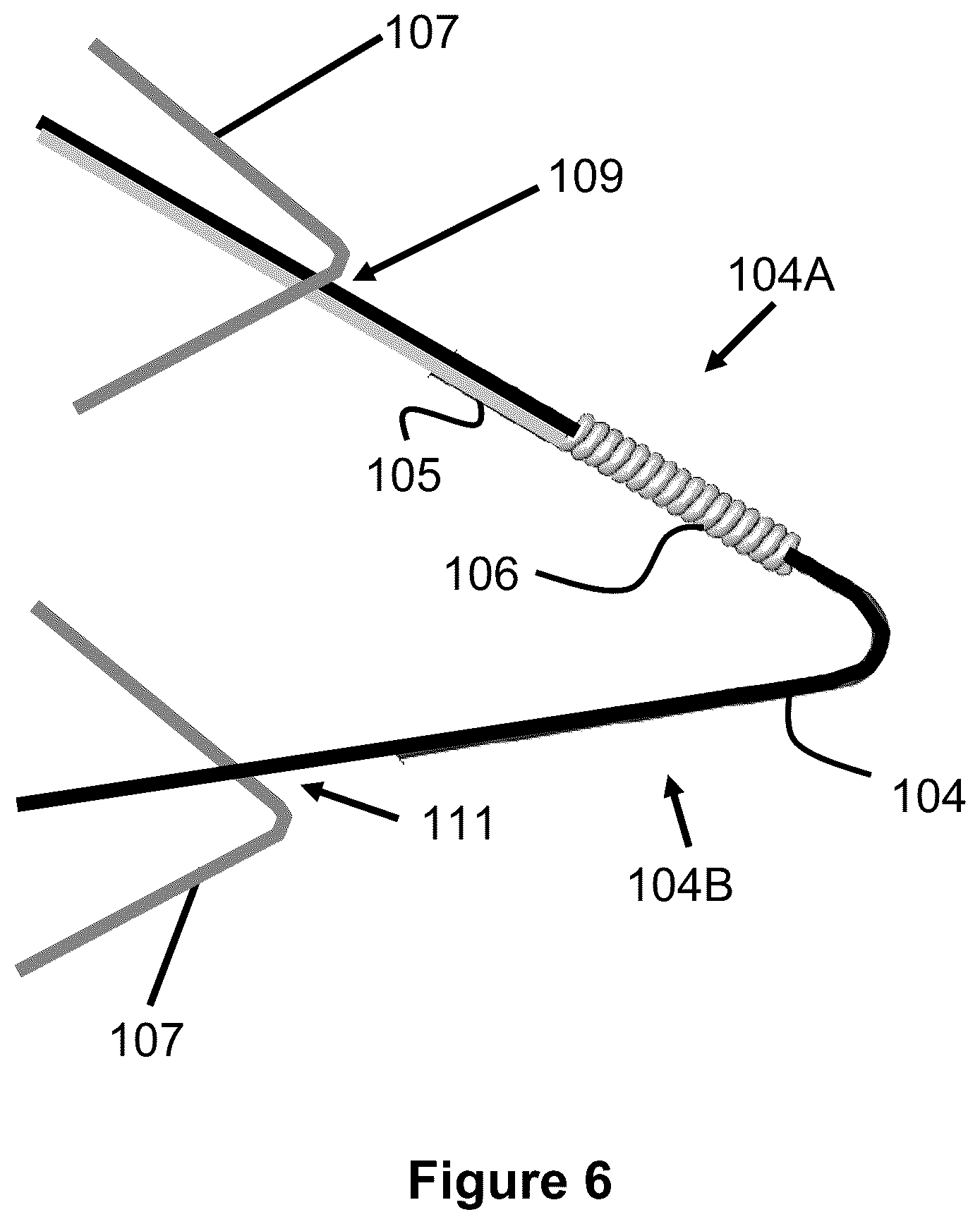 Patent US12167975 Figure 3 – Stent and stent delivery device