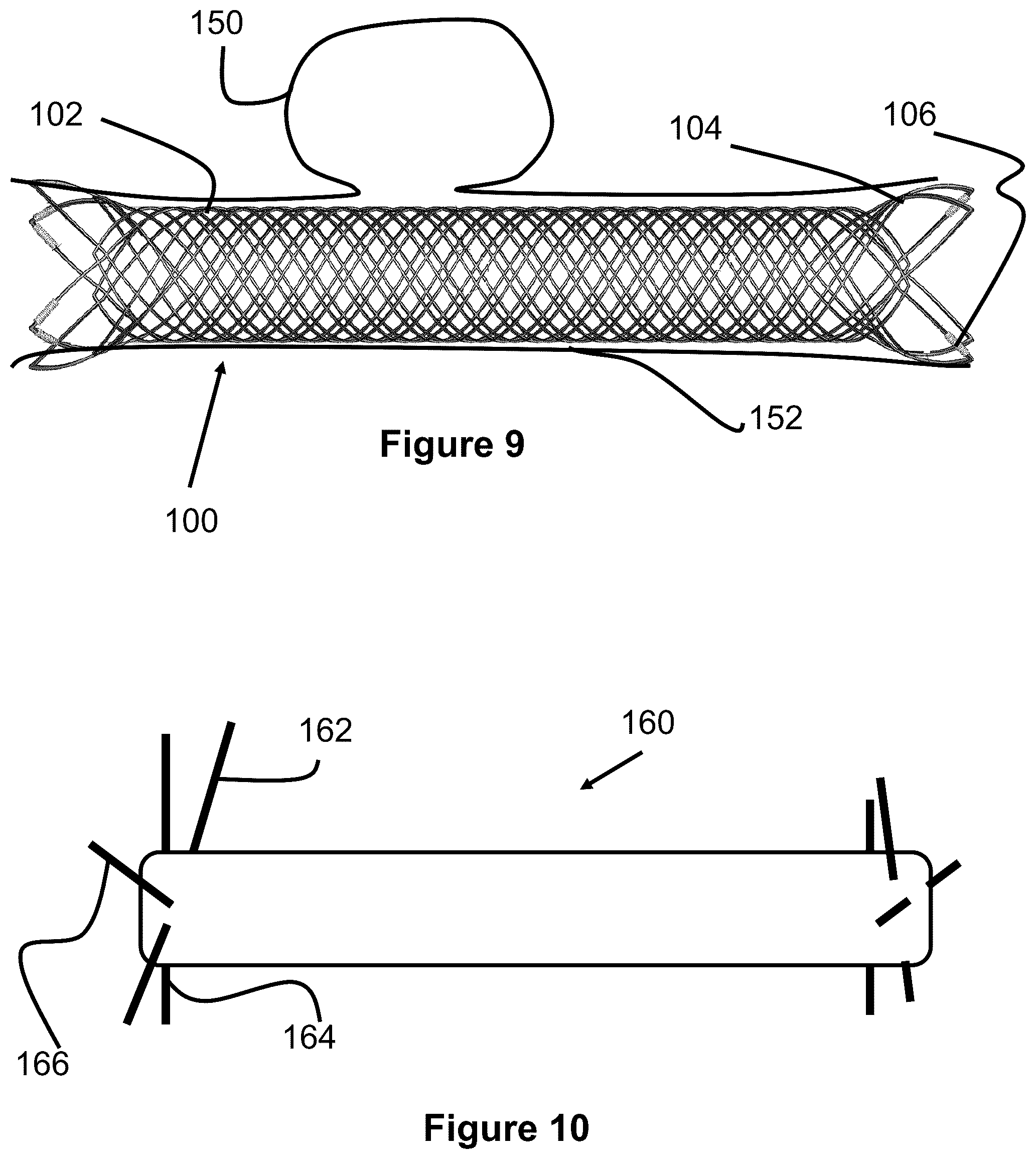 Patent US12167975 Figure 6 – Stent and stent delivery device