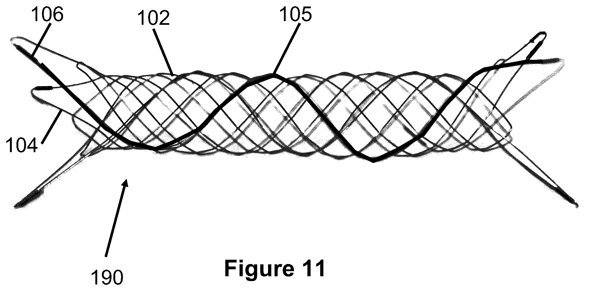 Patent US12167975 Figure 7 – Stent and stent delivery device