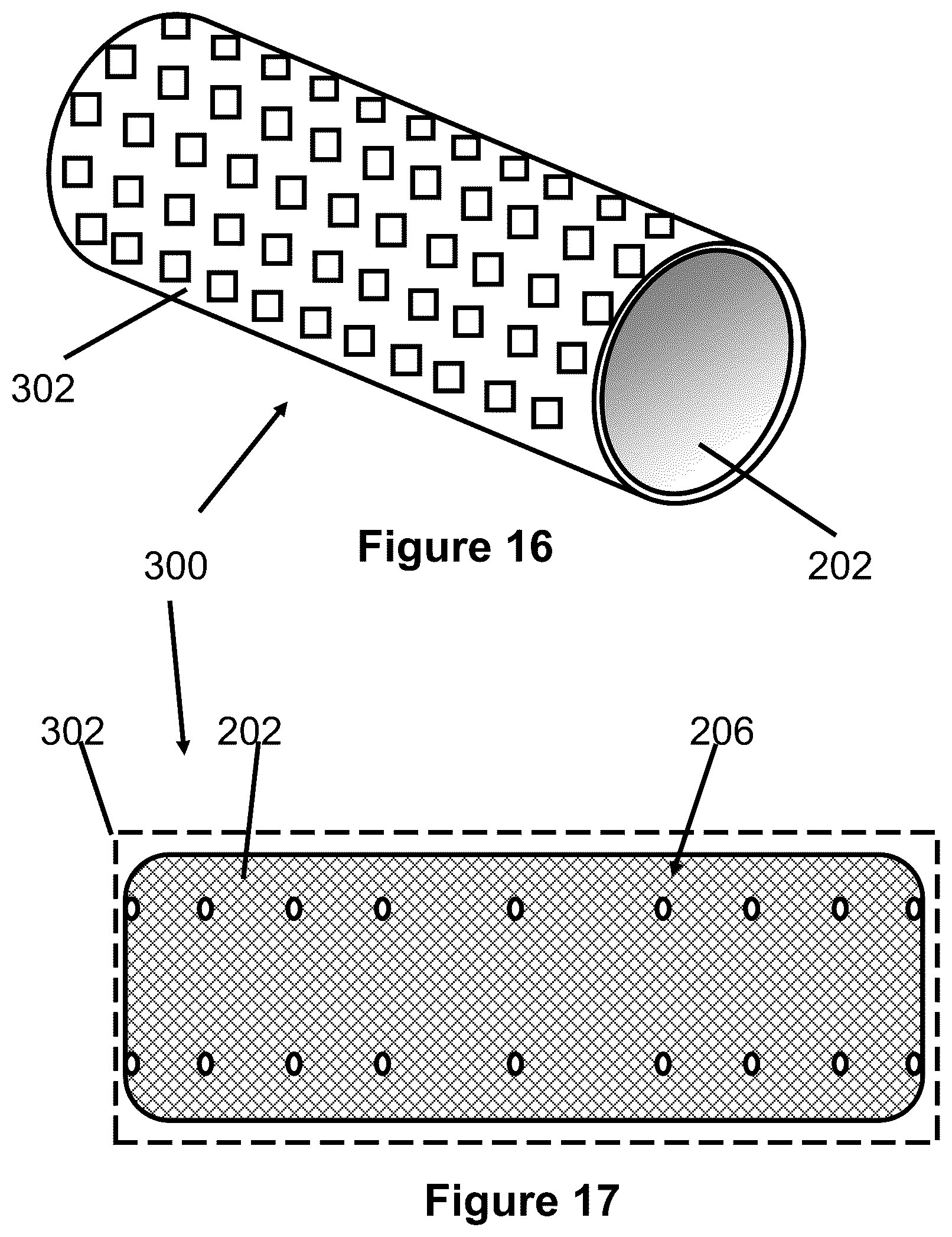 Patent US12167975 Figure 10 – Stent and stent delivery device