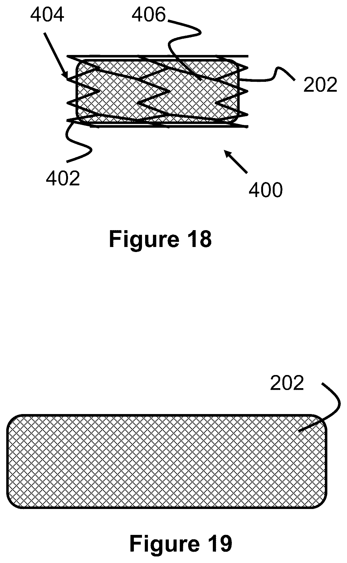 Patent US12167975 Figure 11 – Stent and stent delivery device