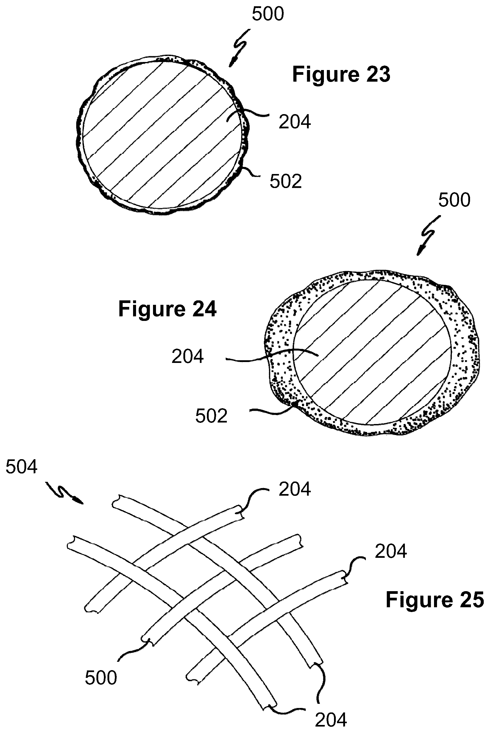 Patent US12167975 Figure 13 – Stent and stent delivery device