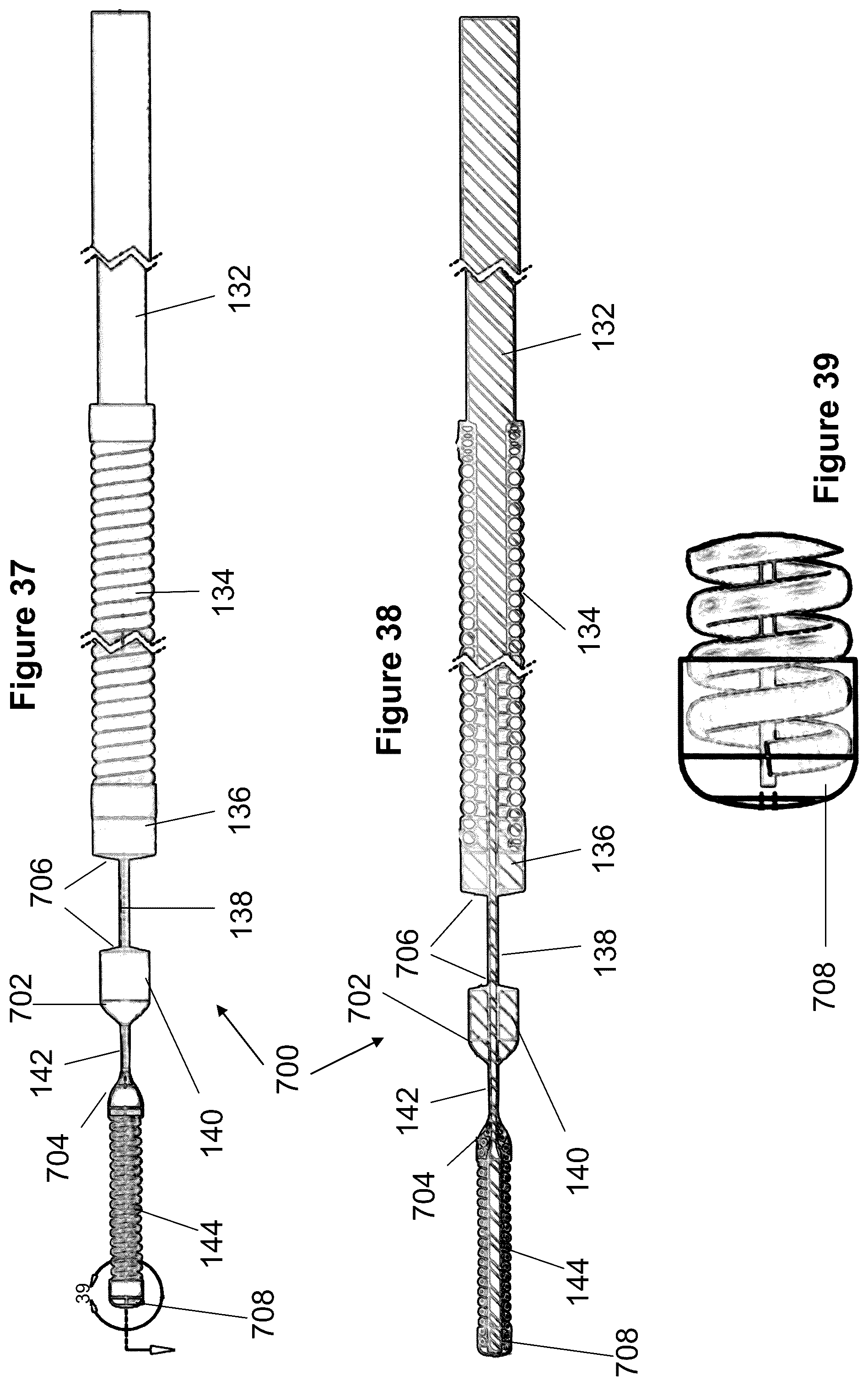 Patent US12167975 Figure 18 – Stent and stent delivery device
