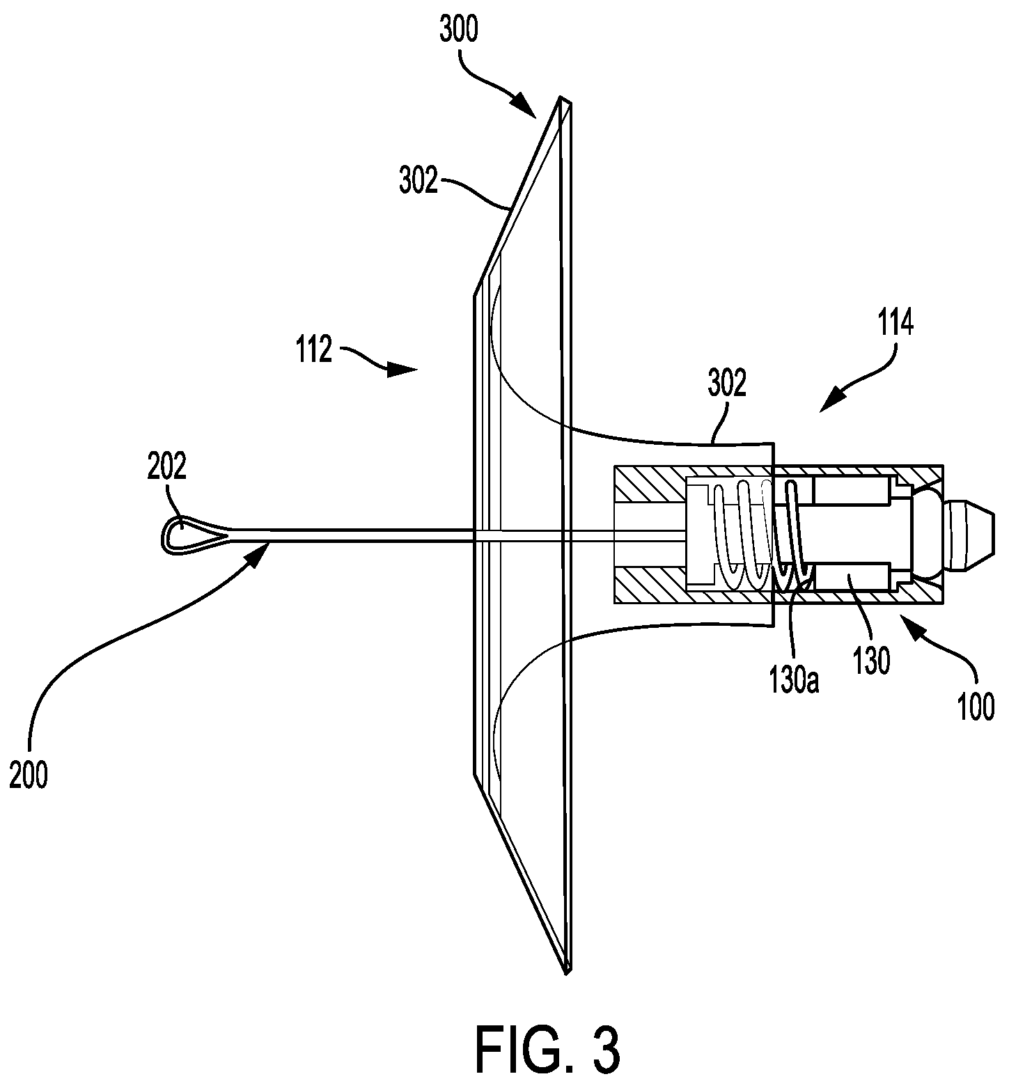 Patent US12167976 Figure 3 – Check valve with docking station for gastrointestinal balloon
