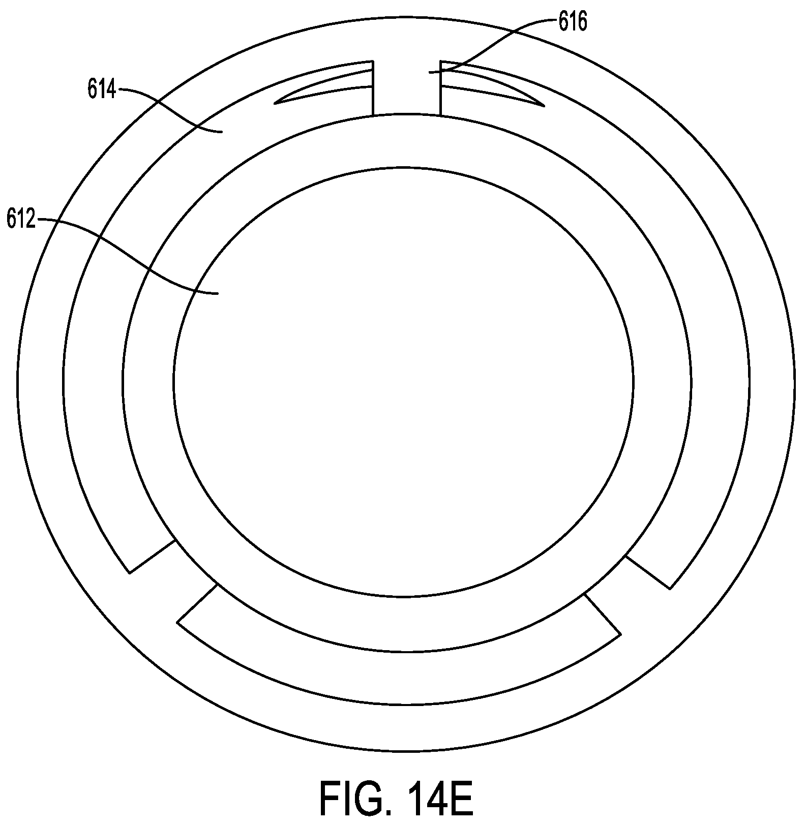 Patent US12167976 Figure 16 – Check valve with docking station for gastrointestinal balloon