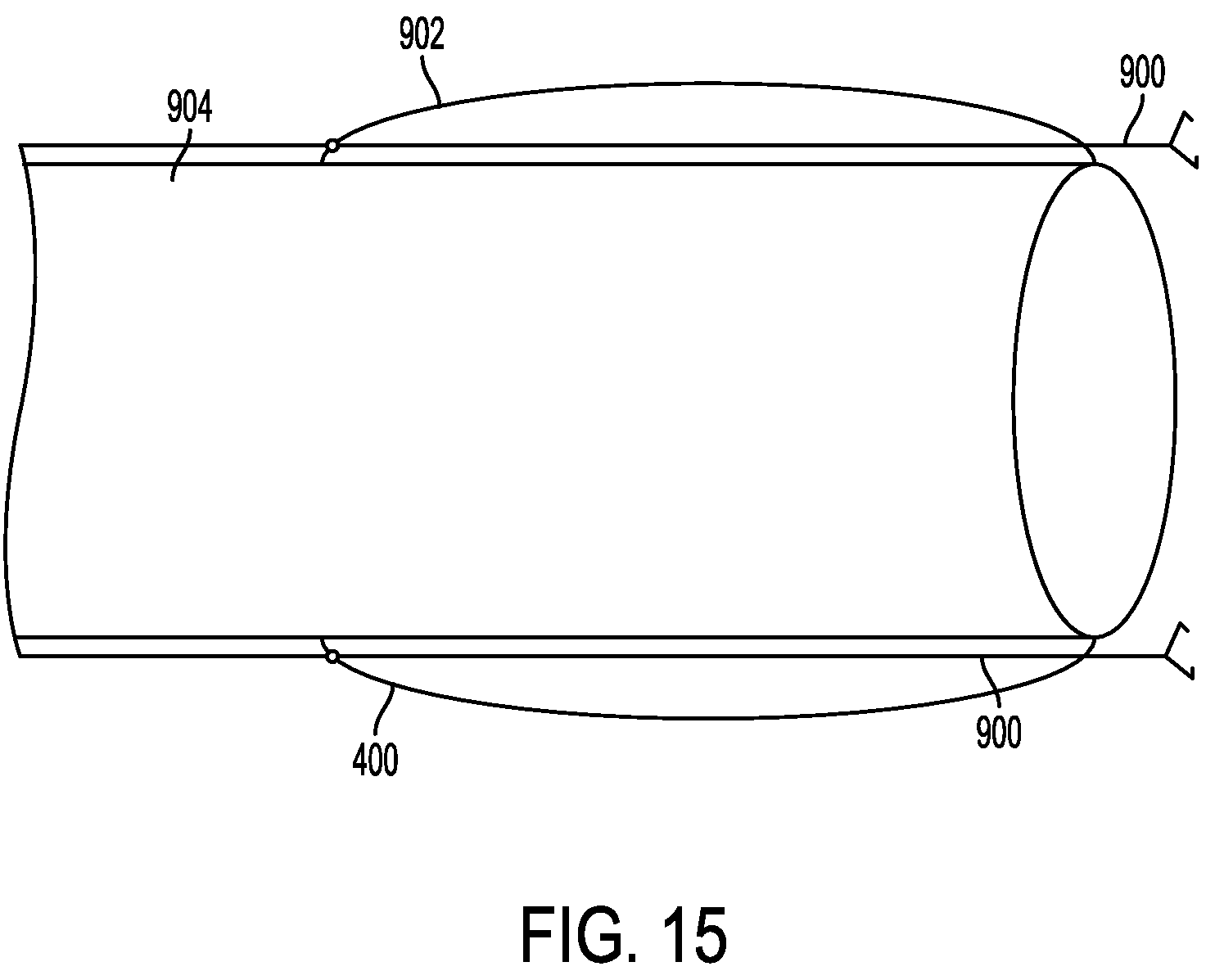 Patent US12167976 Figure 17 – Check valve with docking station for gastrointestinal balloon