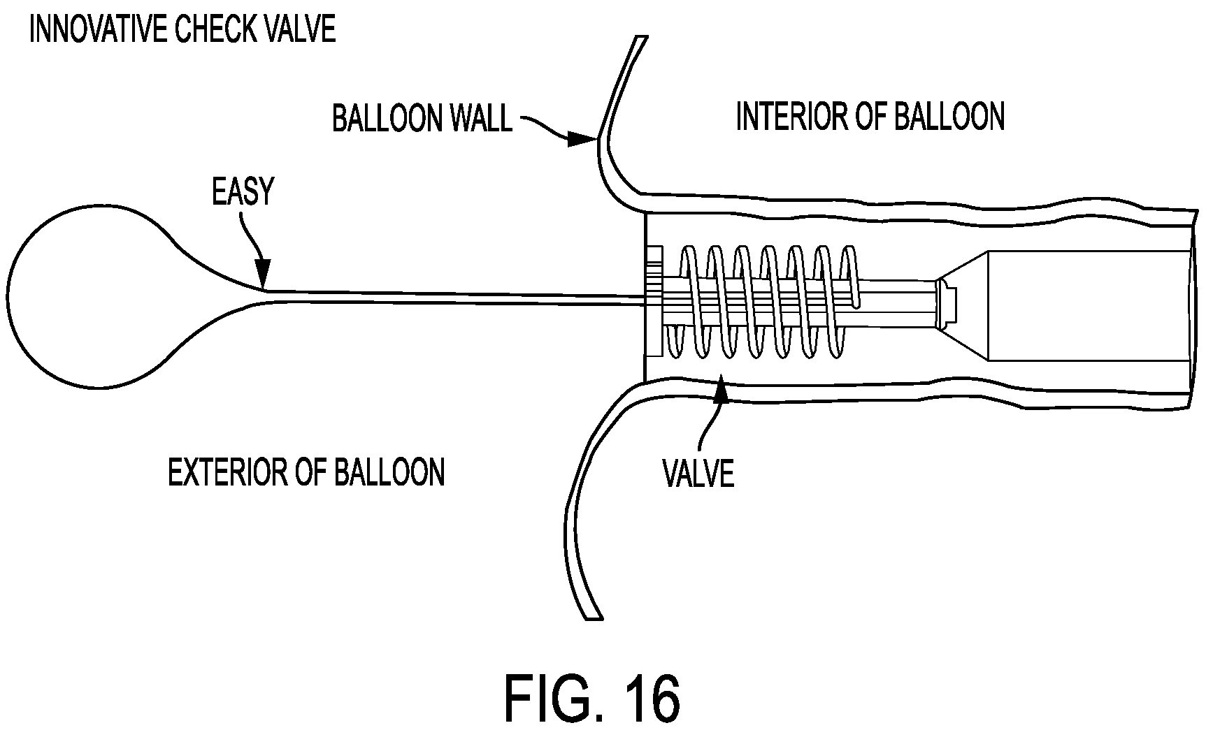 Patent US12167976 Figure 18 – Check valve with docking station for gastrointestinal balloon